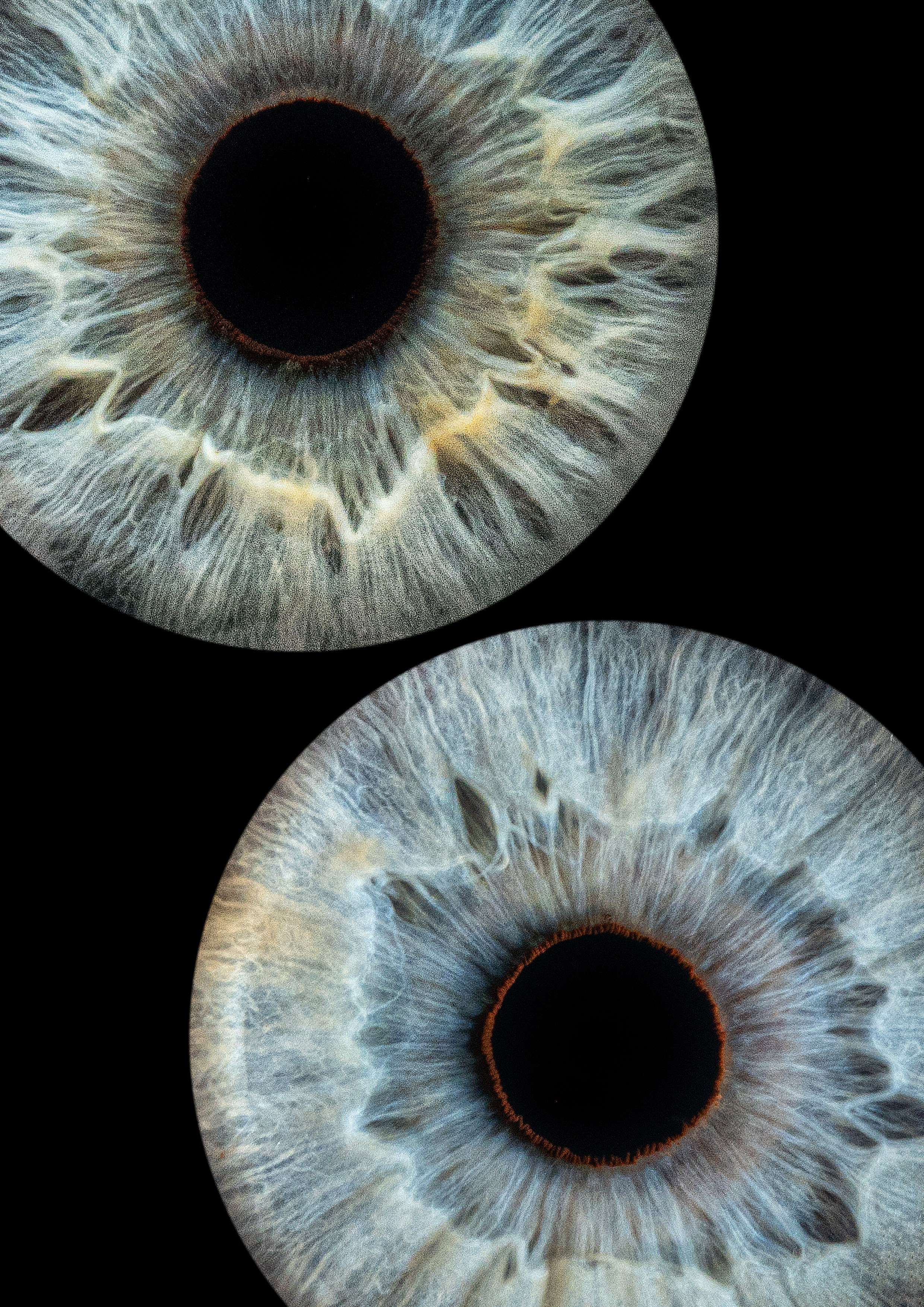 Примеры работ. Мой глаз