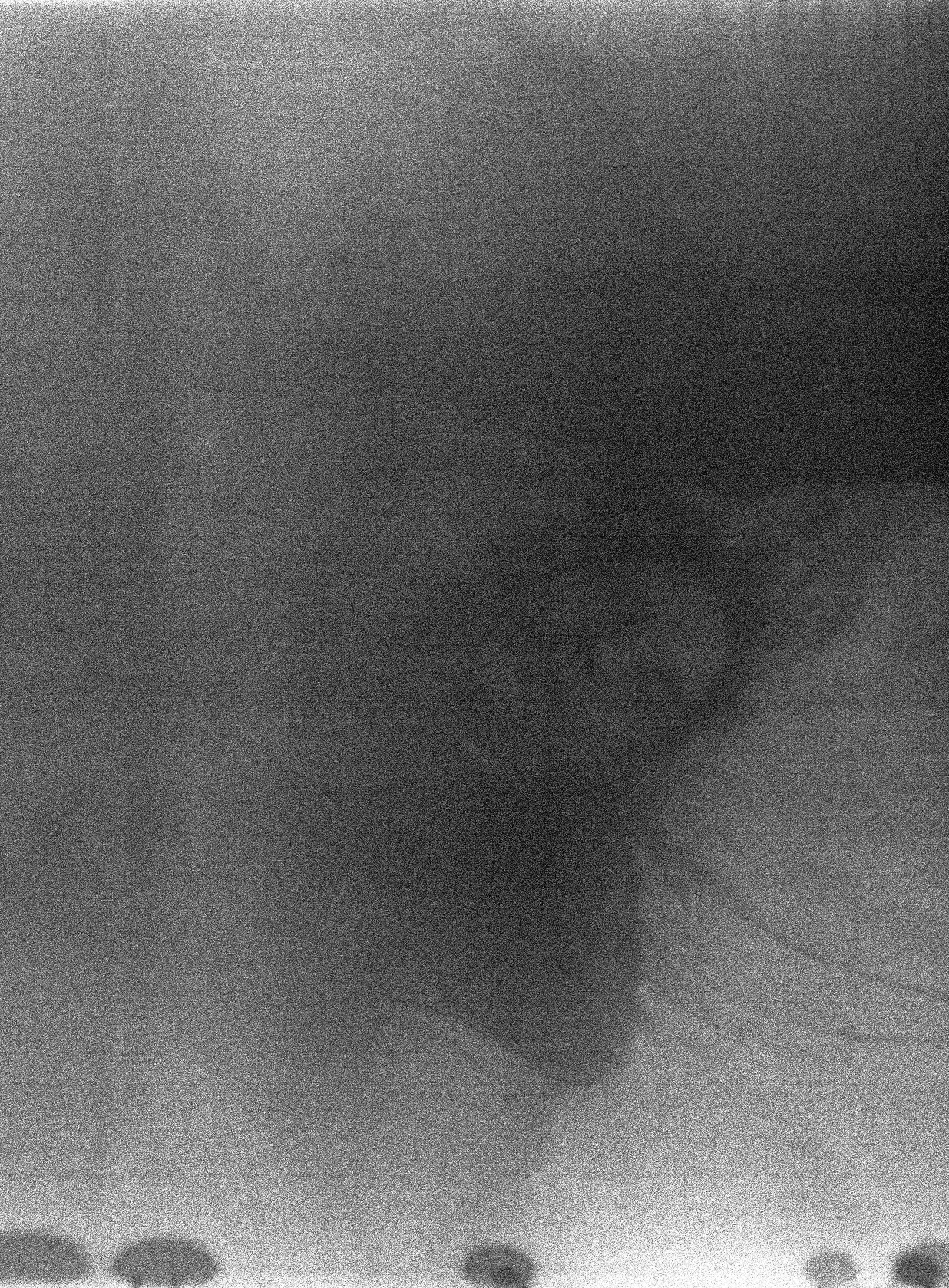 Проект «The Sun Burns» французской художницы Чочана Россо (Chochana Rosso). Private image