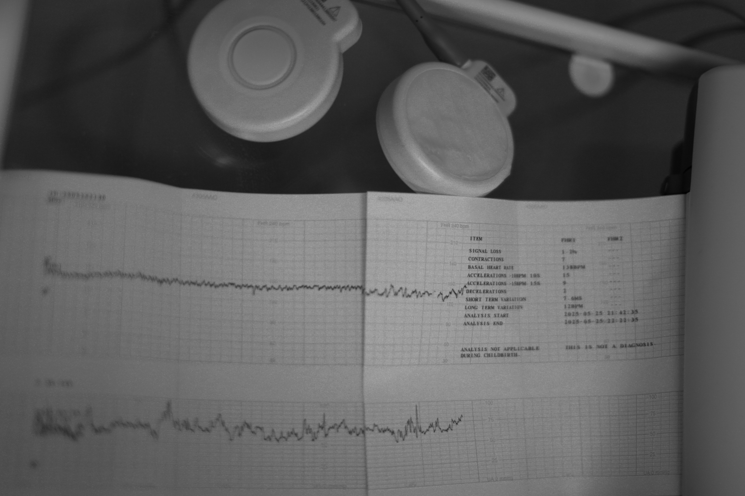 Рождение Яна. Фотограф Олеся Милош Мытищи, Москва и МО и весь мир