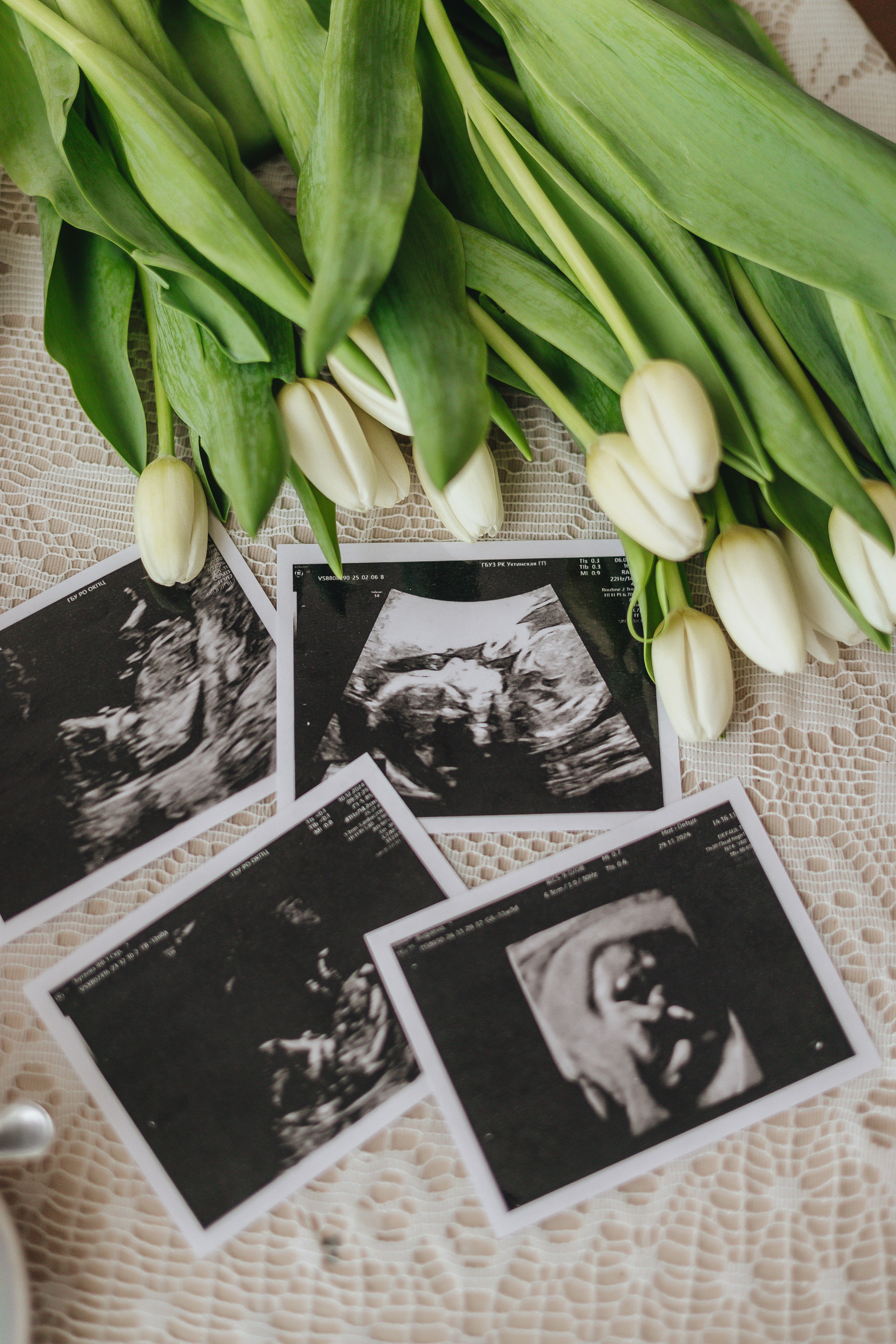 Флора. В ожидании. Свадебный и семейный фотограф Пушкин Царское Село СПБ Питер Санкт-Петербург и Рязань Ольга Козлова