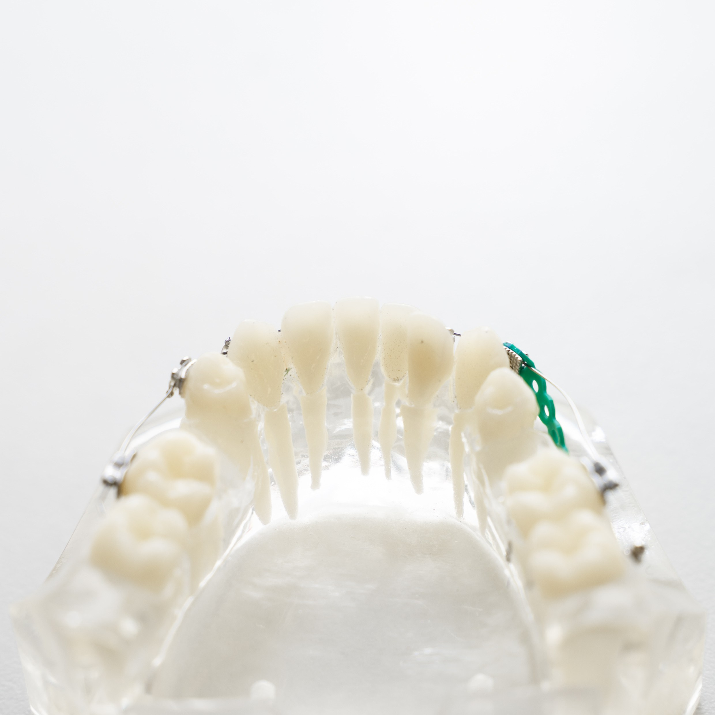 Предметка. Фотограф Миланазавр