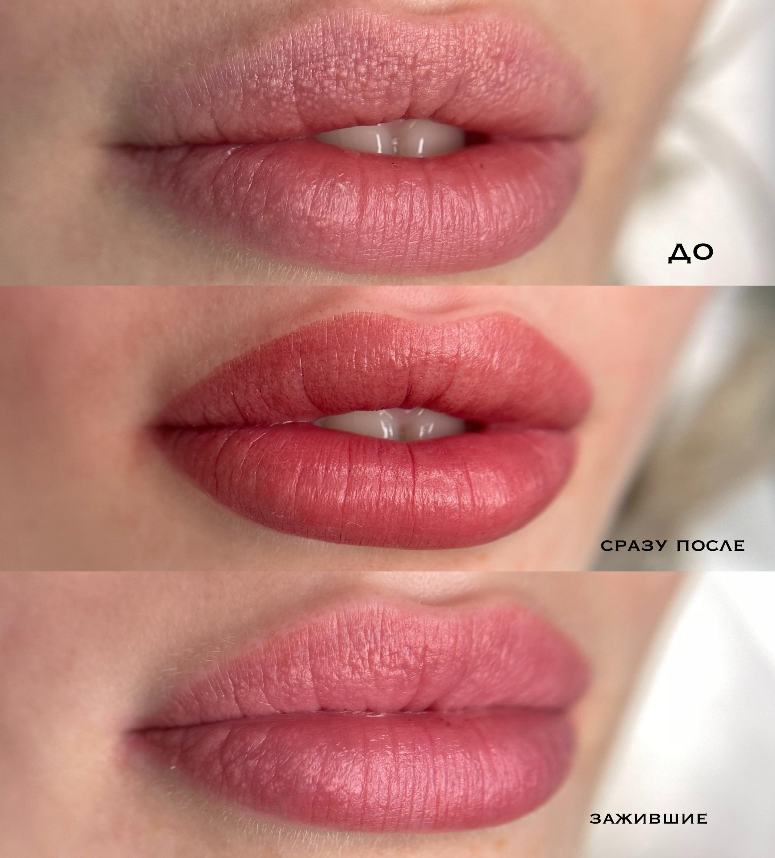 ГУБЫ сразу после процедуры. Перманентный макияж и удаление старого татуажа в Ростове-на-Дону Дарья Исакова