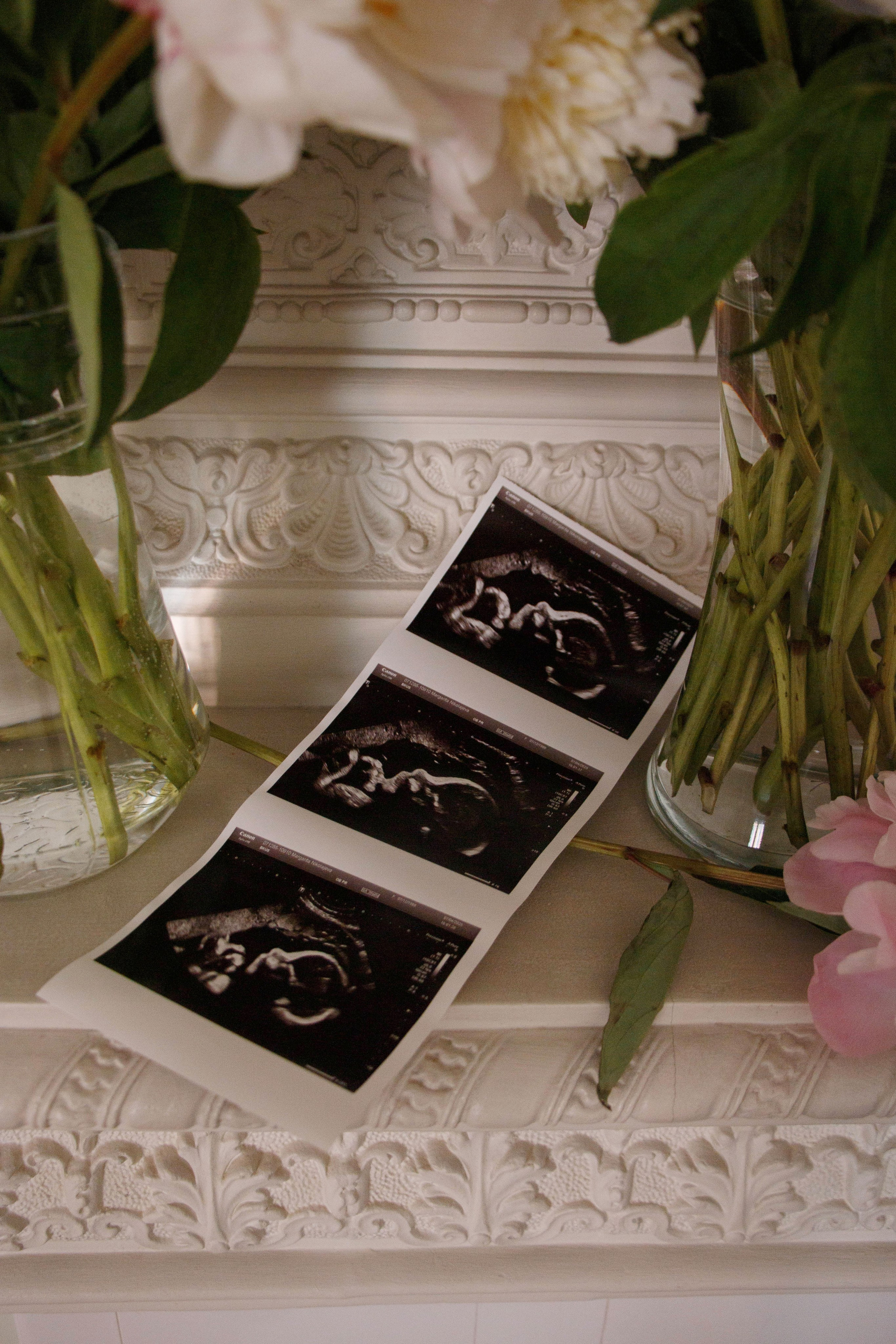 MARGARYTA. Бережно сохраняю ваши чувства и истории на своих фотографиях