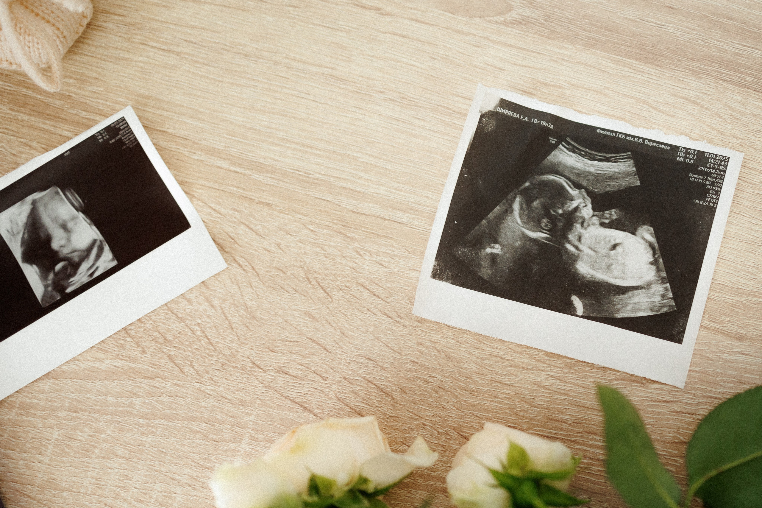 Скоро дважды мама. Фотограф Москва Светлана Кирюшина