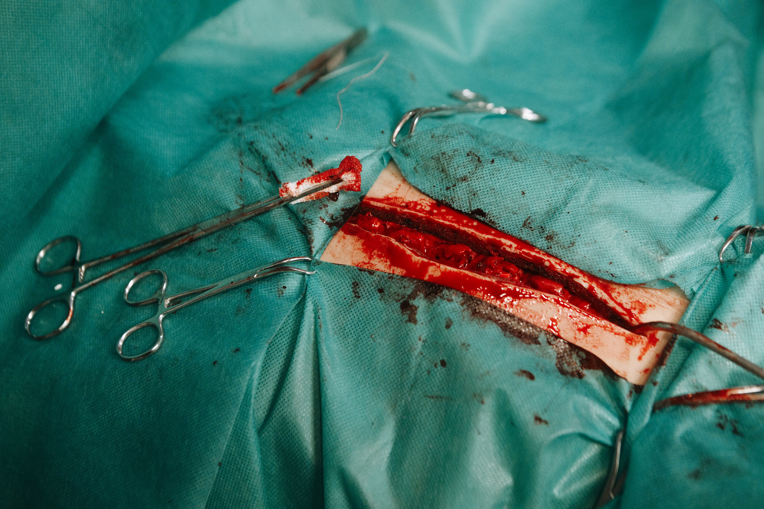 Склифосовский: за кадром. Фотограф Дмитрий Тур — профессиональная фотосъемка мероприятий и портретов в Москве и Московской области