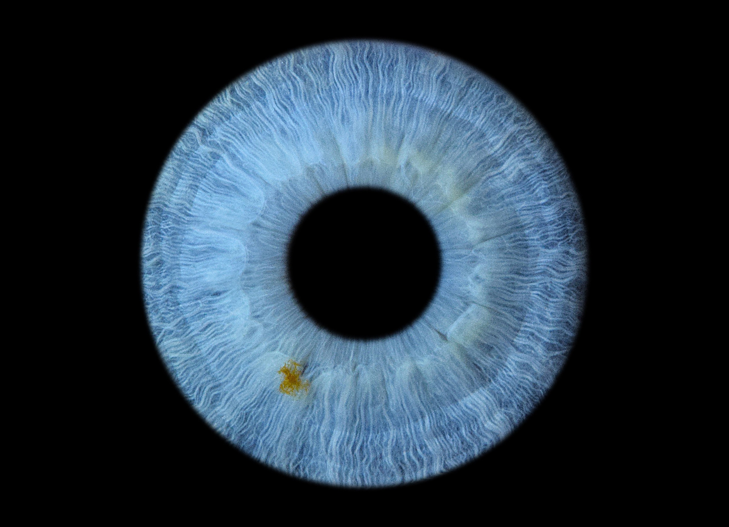 Портфолио. EYEtob | Фотография радужной оболочки | Тобольск