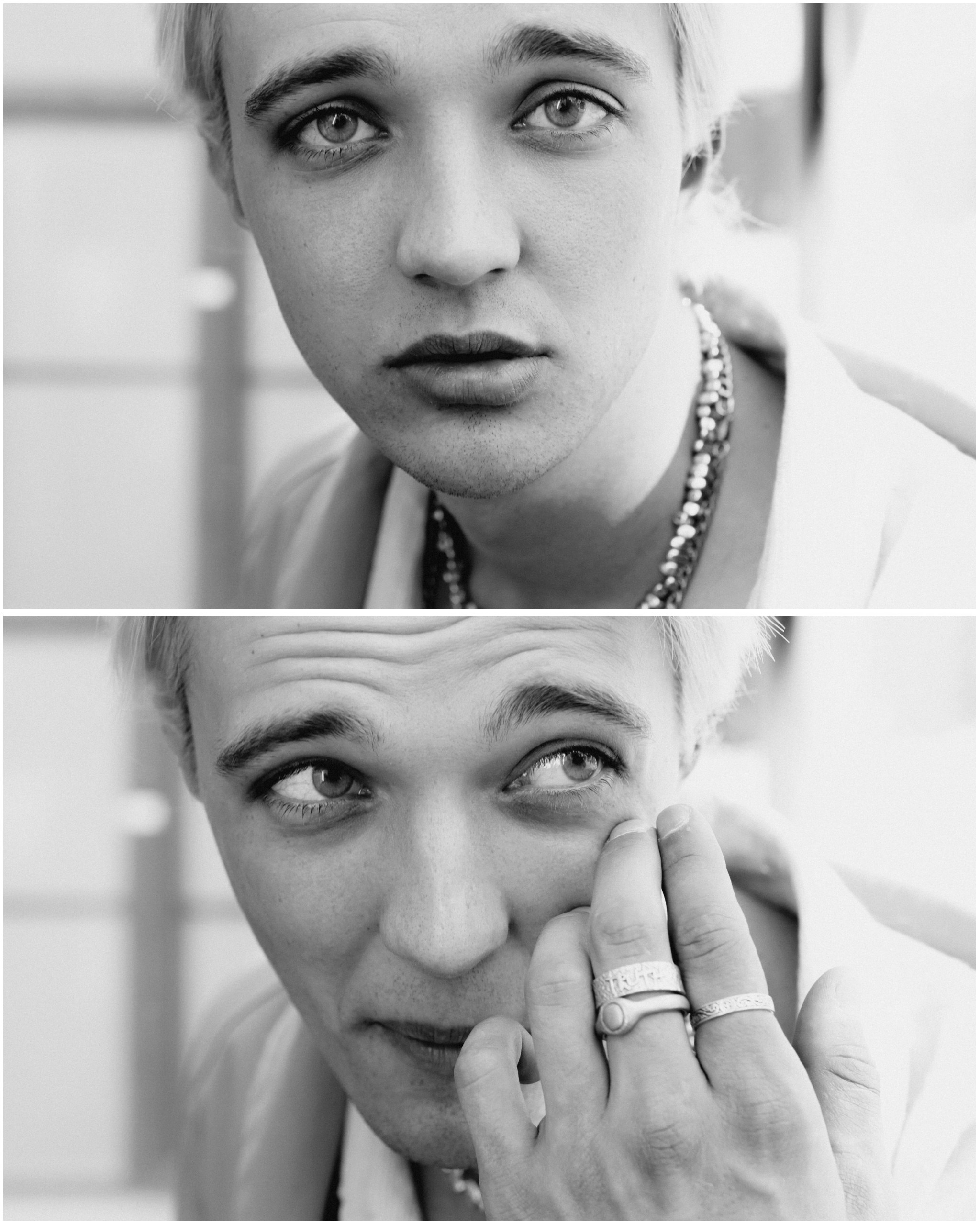 парень в кольцах трет глаз