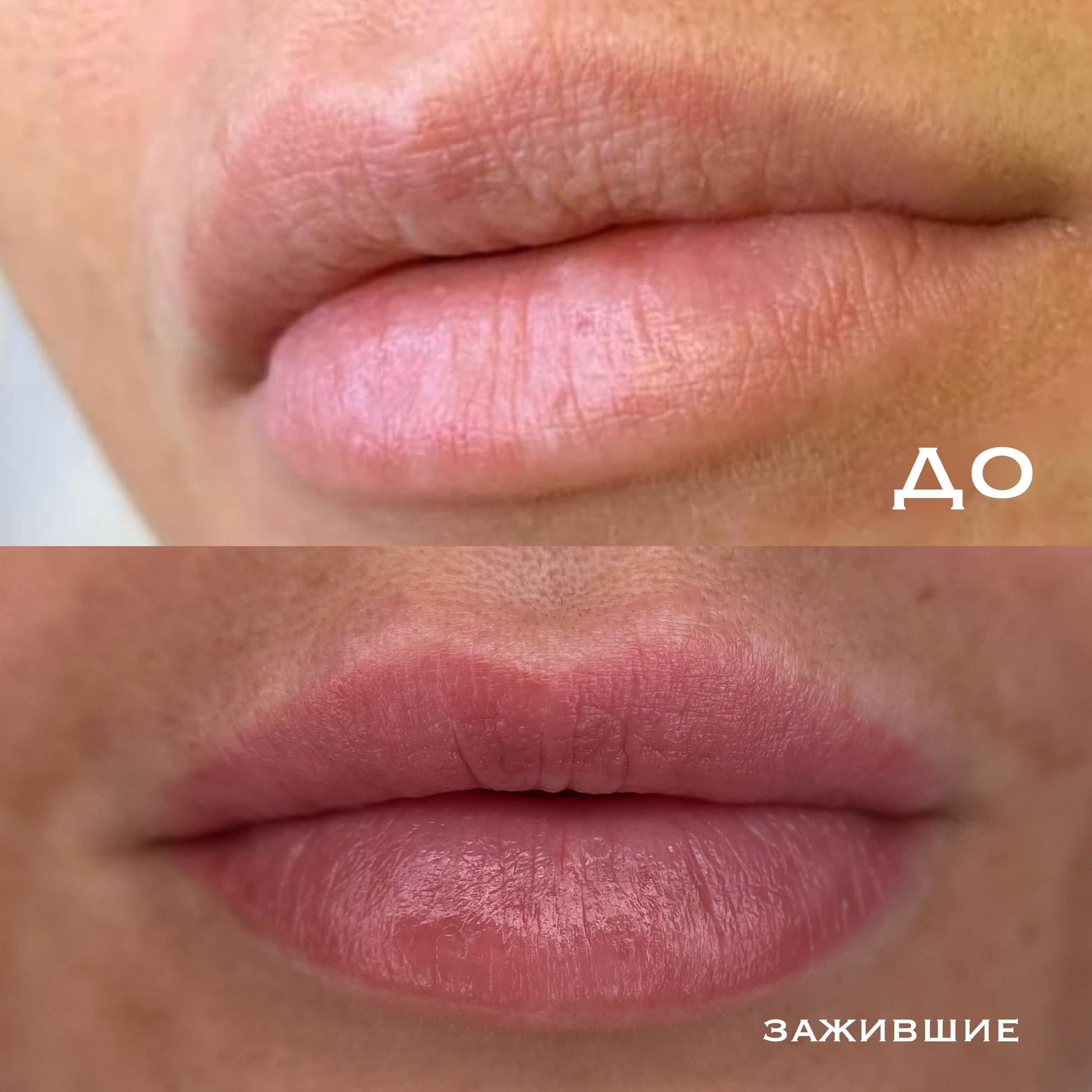 ГУБЫ зажившие. Перманентный макияж и удаление старого татуажа в Ростове-на-Дону Дарья Исакова