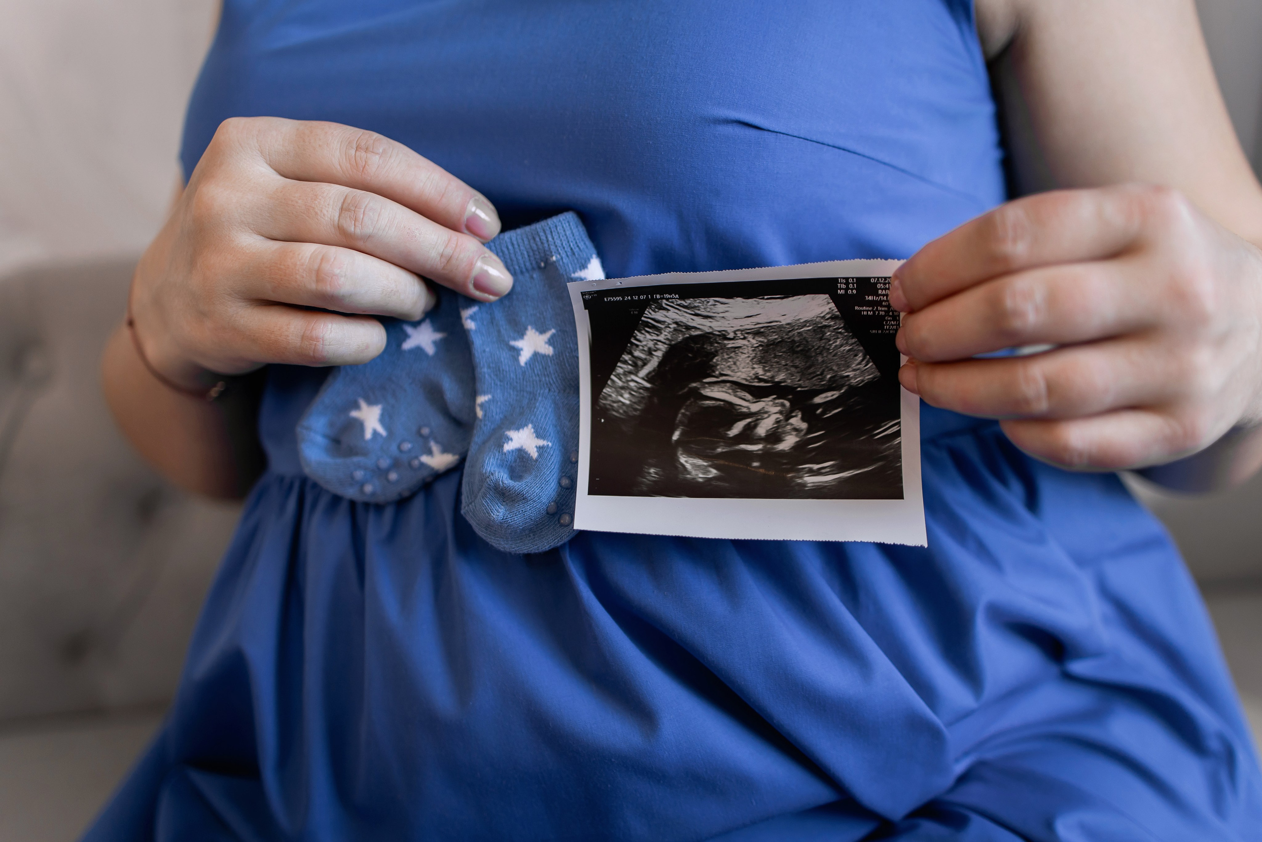 Baby. Anne Miller | Photographer