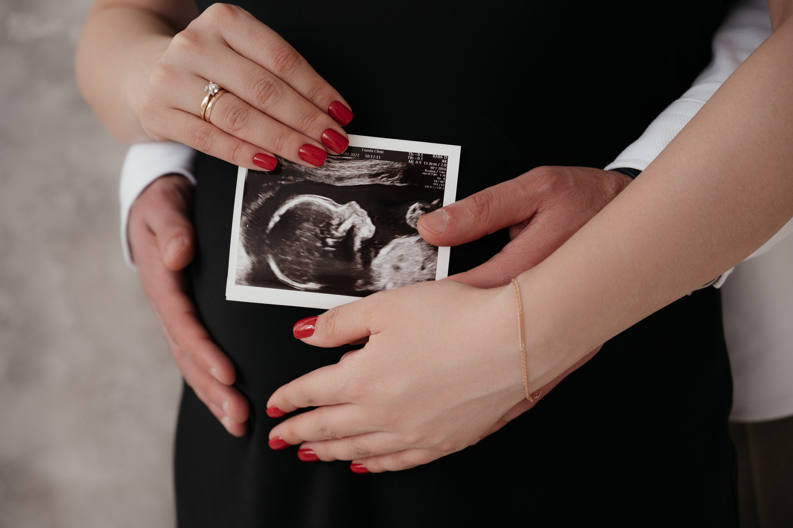 Вусал и Мержен. Свадебный и семейный фотограф Вероника Холод