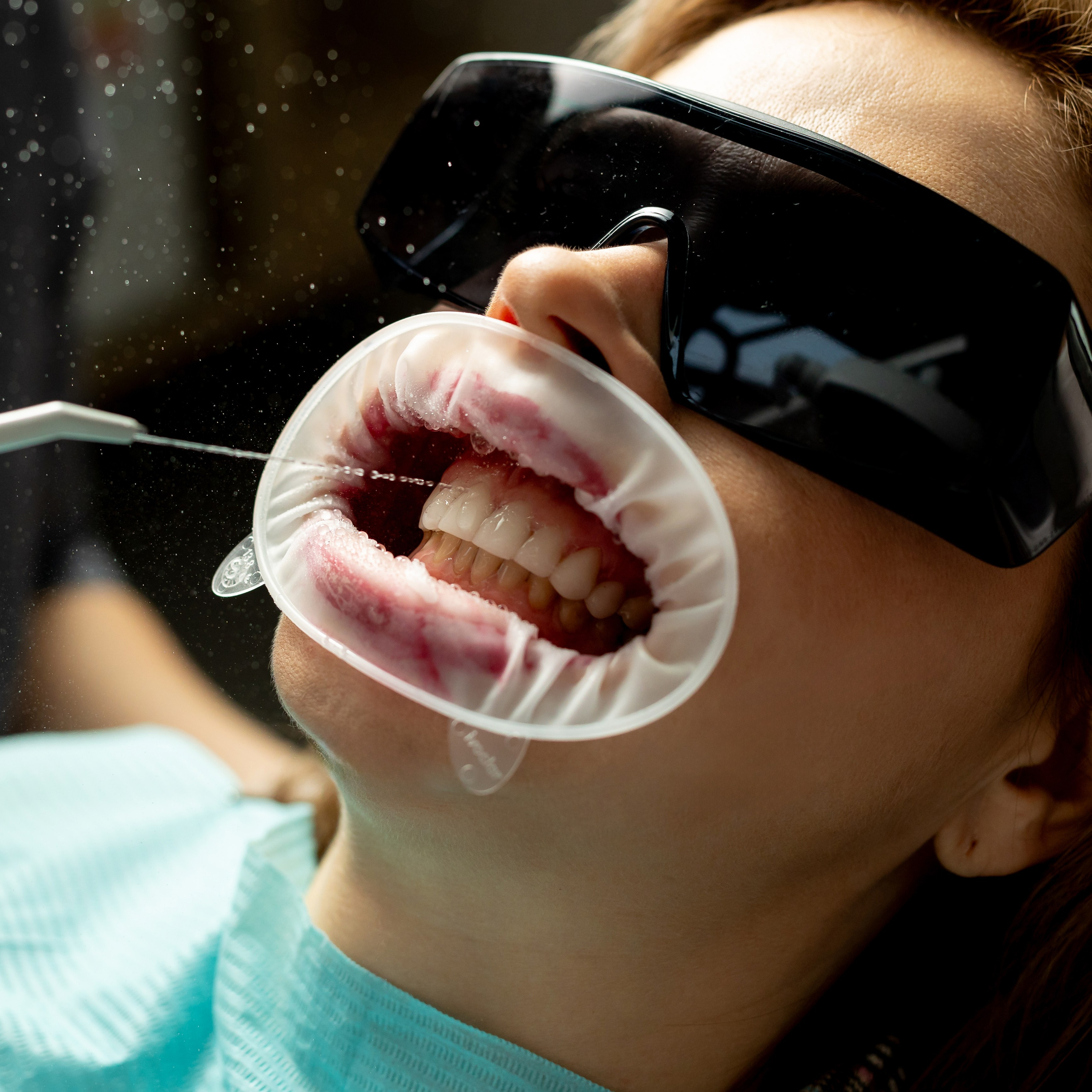 Съемка для клиник. Профессиональный фотограф в Санкт-Петербурге Алена Яшина