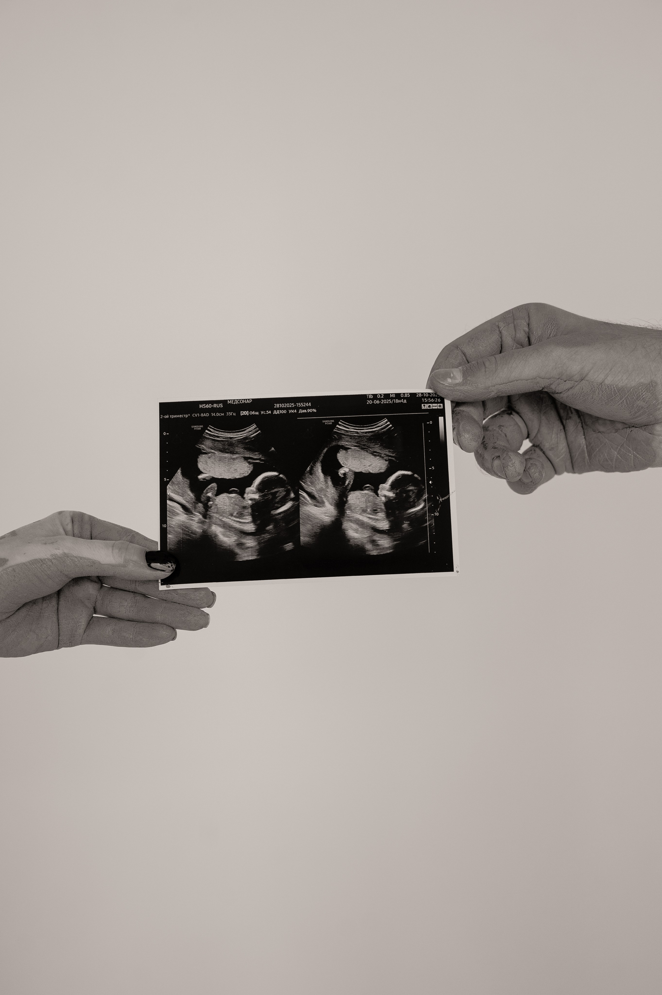 Гендер пати 🤍. Свадебный и семейный фотограф в Краснодаре Алина Мельник