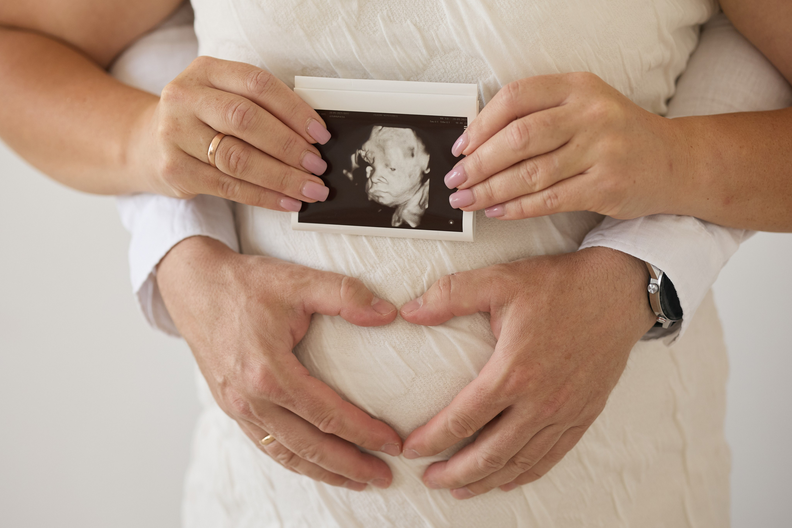 СЕМЕЙНЫЕ/ДЕТСКИЕ. ФОТОГРАФ НОВОРОЖДЕННЫХ ЧЕРЕПОВЕЦ САНКТ-ПЕТЕРБУРГ