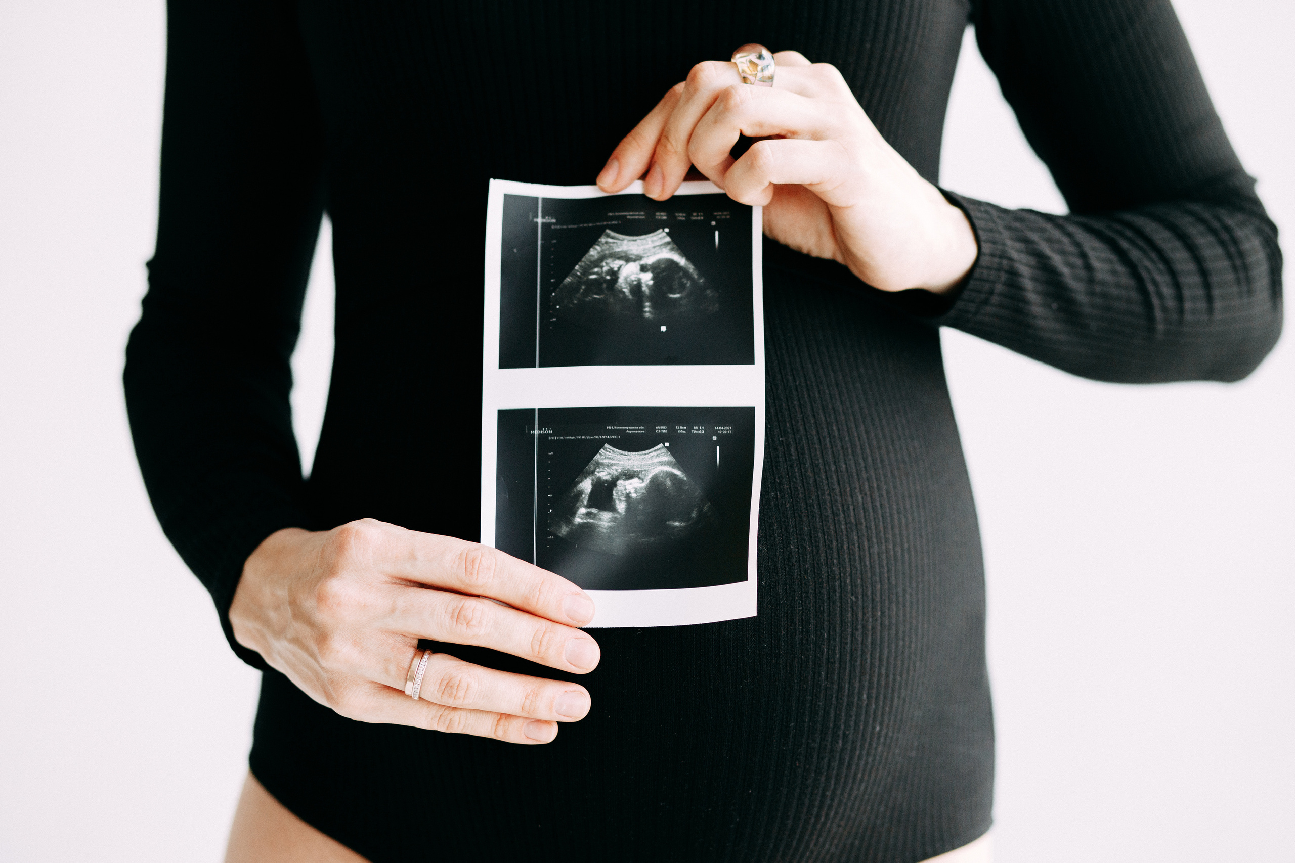 В ожидании чуда • Весна 2021. Фотограф в Калининграде Екатерина Осинцева