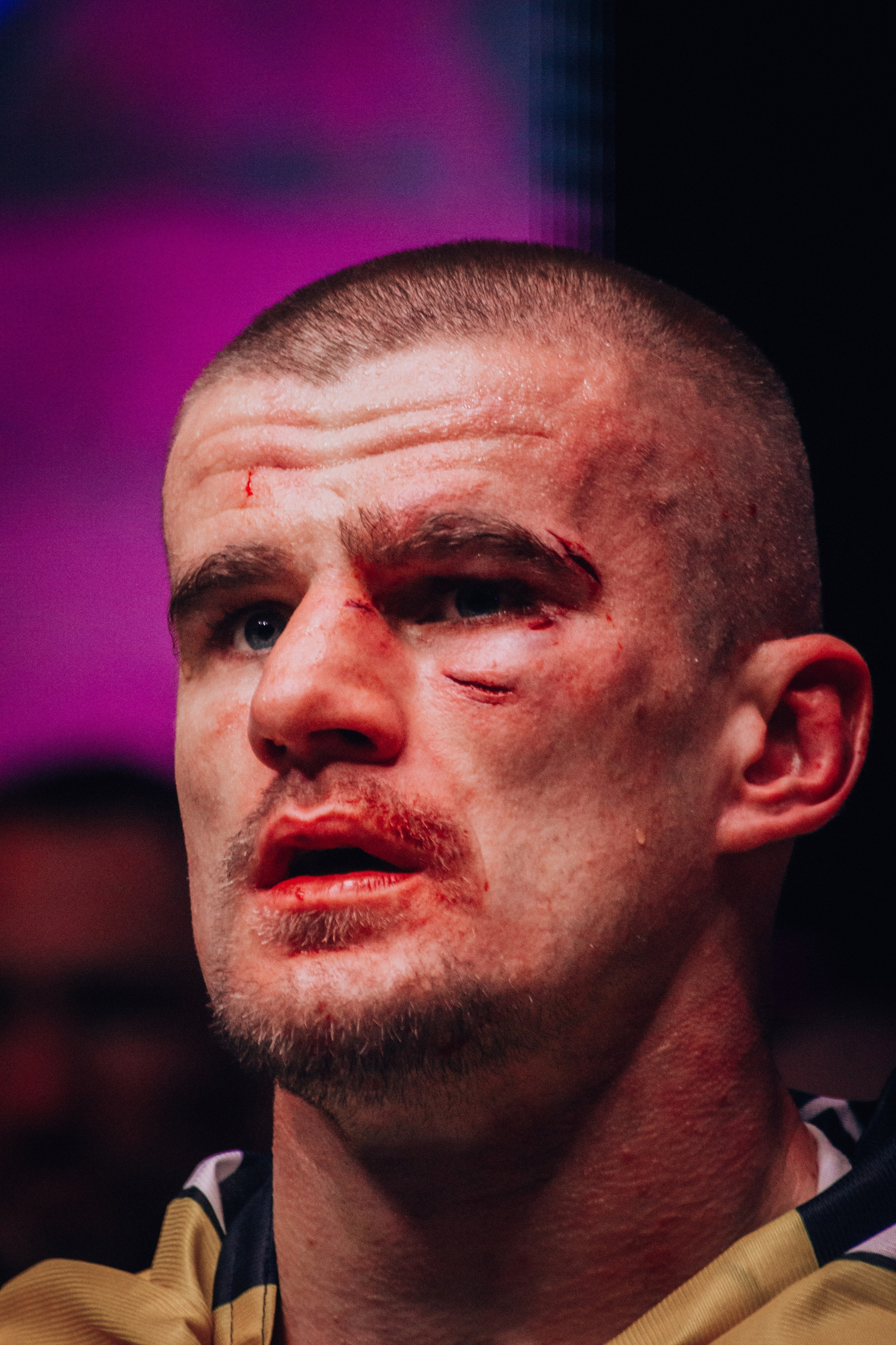 Кулачные бои TopDog. Анастасия Тен