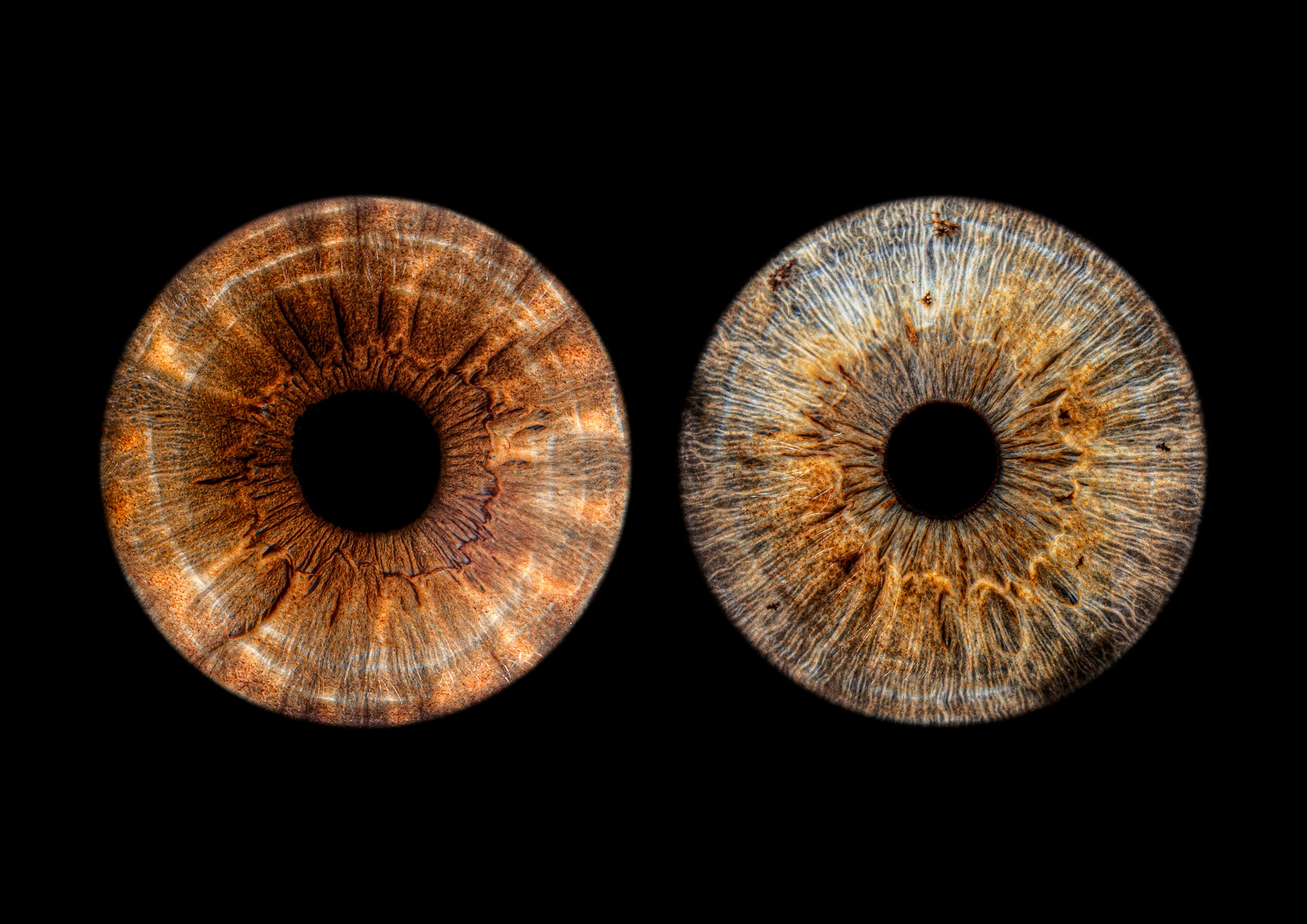 Контакты. Макро Фото радужки глаза в Зеленоградске