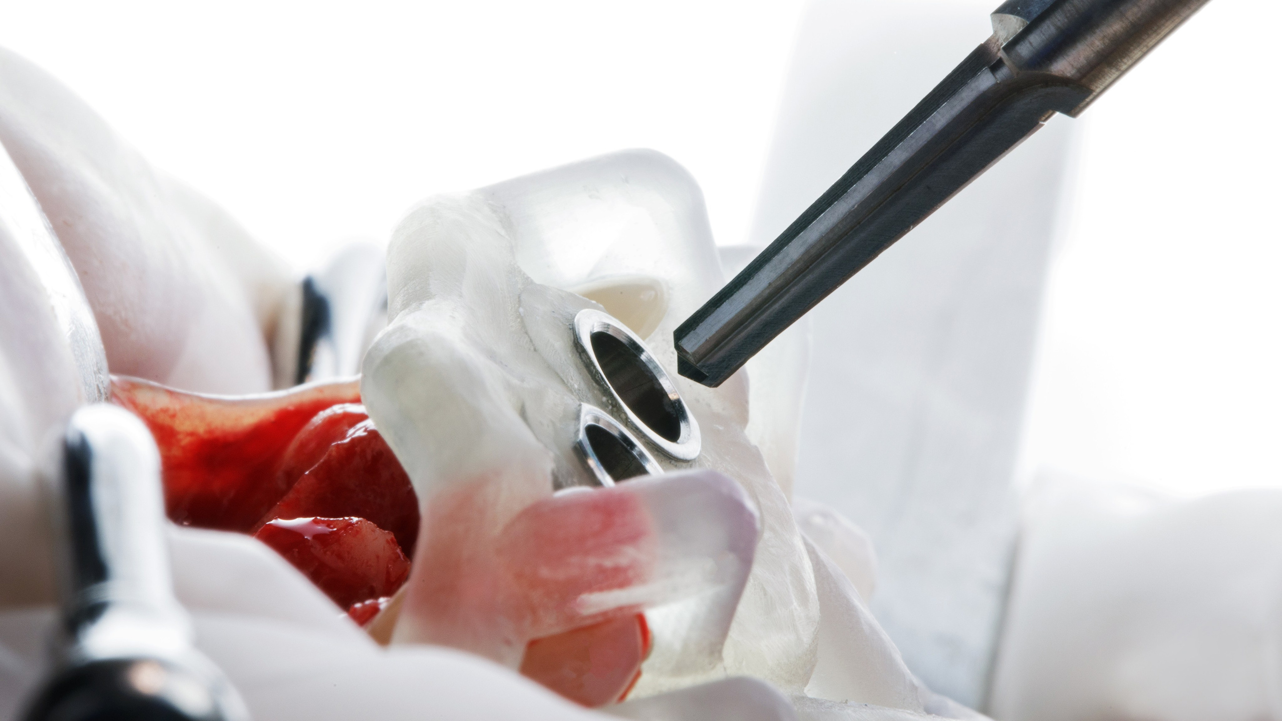 Хирургия. Дентал фотограф — видеограф Денис Дорошенко