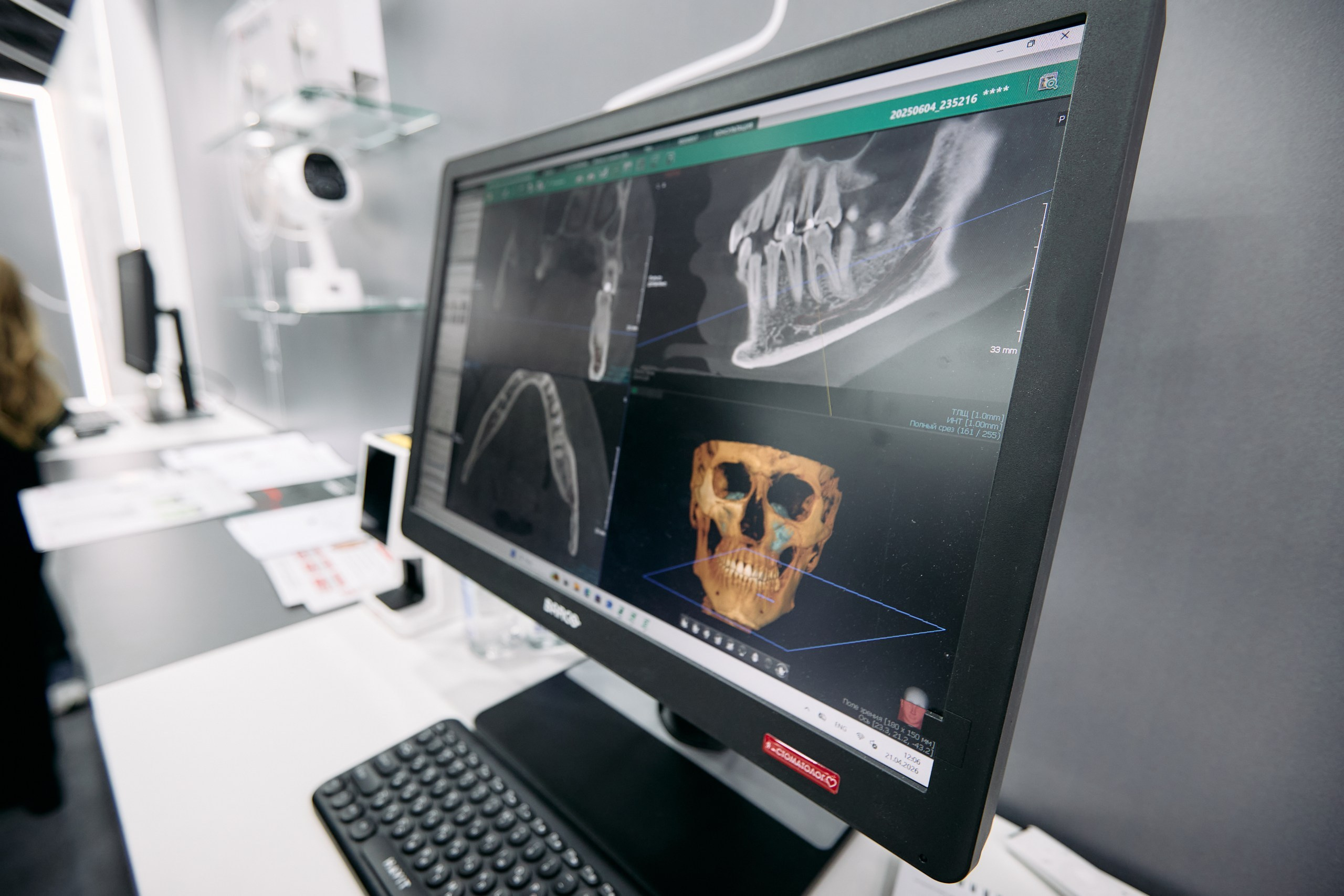 Дентал Салон 2026: Vatech. Свадебный и репортажный фотограф Дмитрий Кононенко