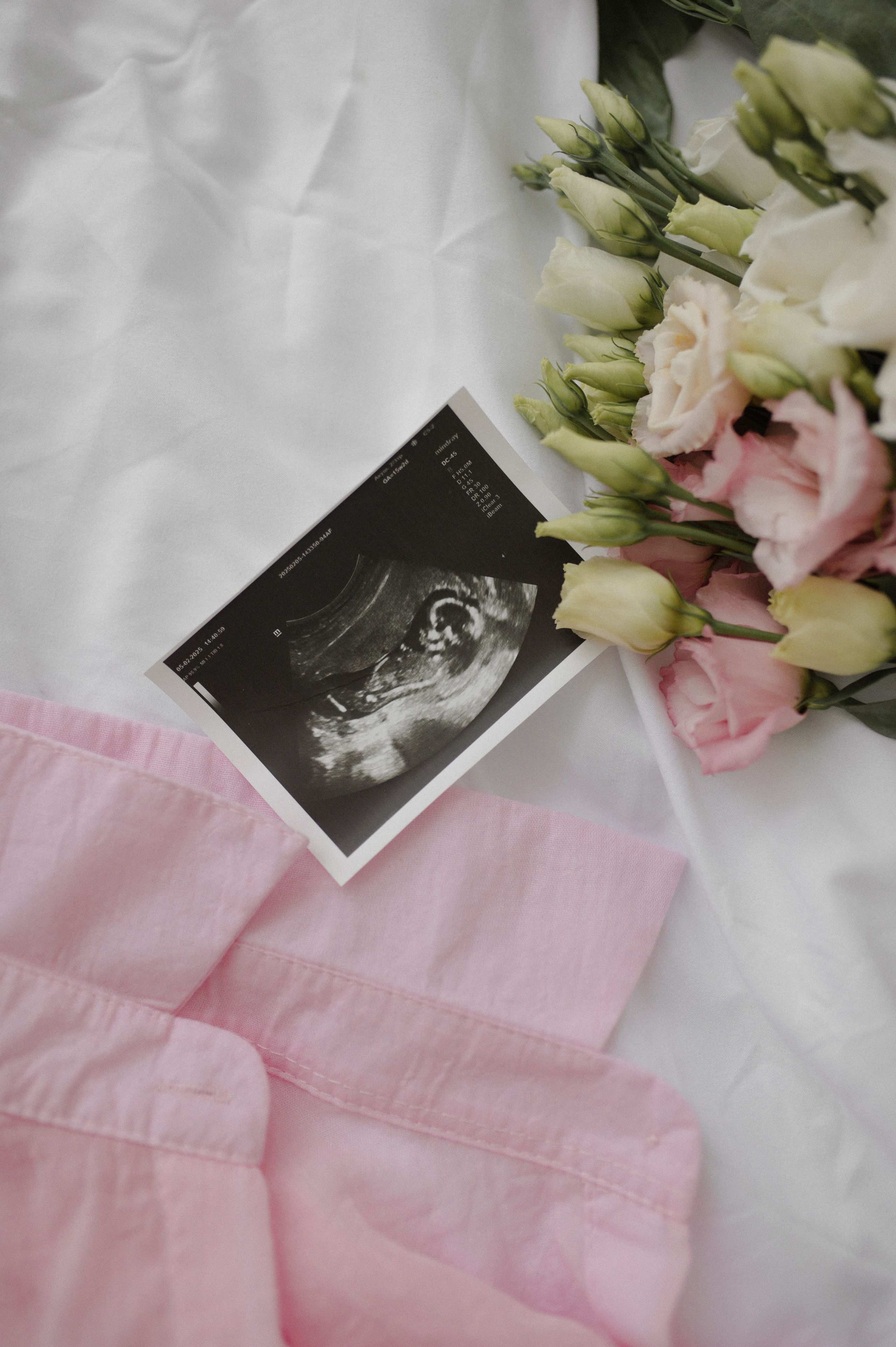 Оля в ожидании малыша. Семейная фотосессия Бутово Москва фотограф Алина Морщагина