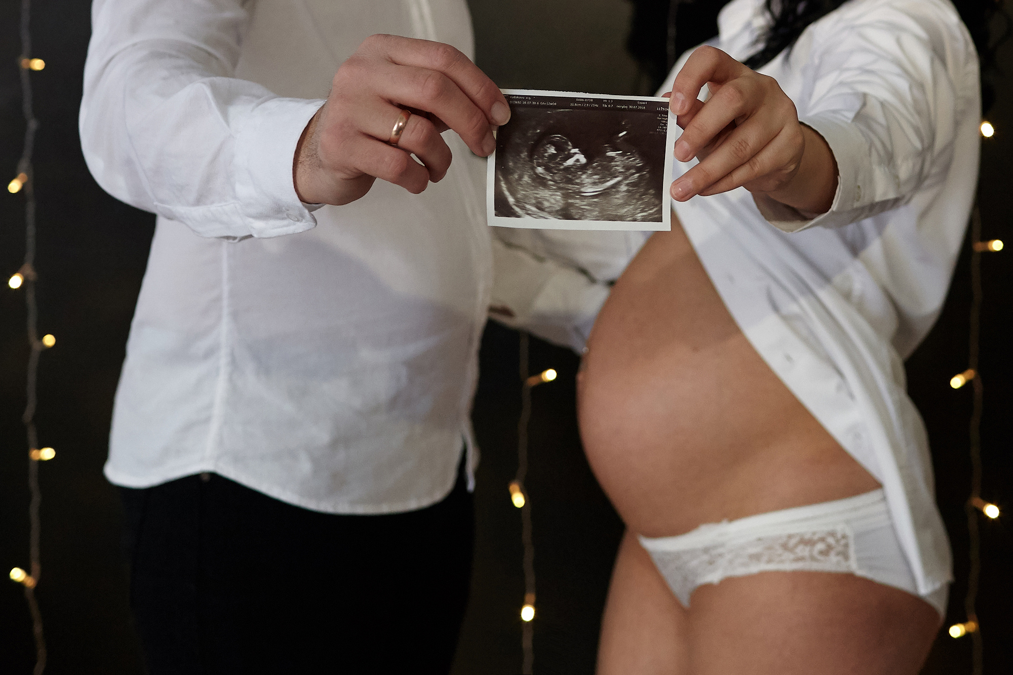 Студийная фотосессия в ожидании своей принцессы. Фото видео съёмка в Белой Калитве дуэт Герман и Инна