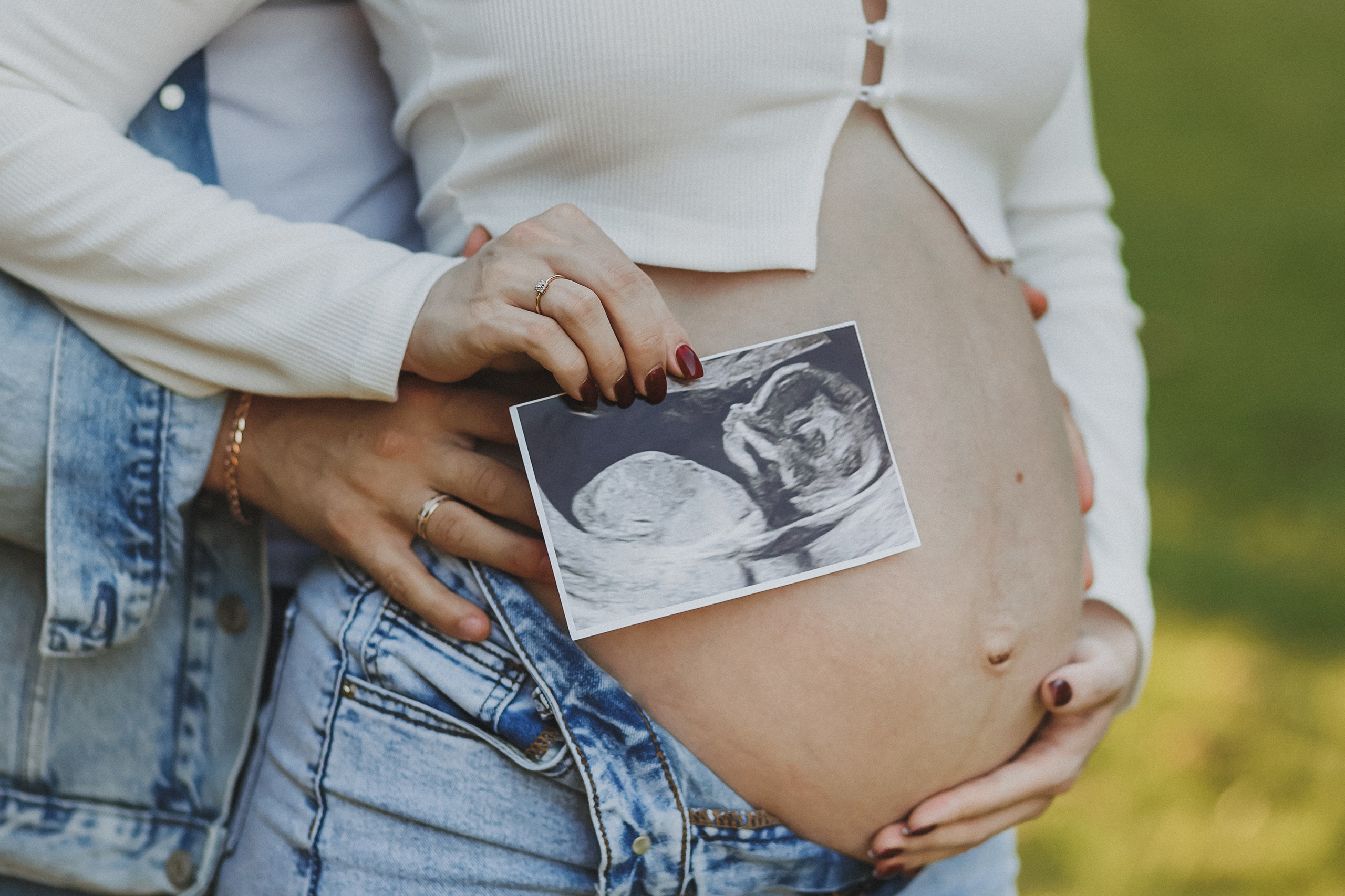 Фотосессии в Кусково. Фотограф в Москве и Люберцах Анна Ушакова. Фотосессия беременности Люберцы и Москва.