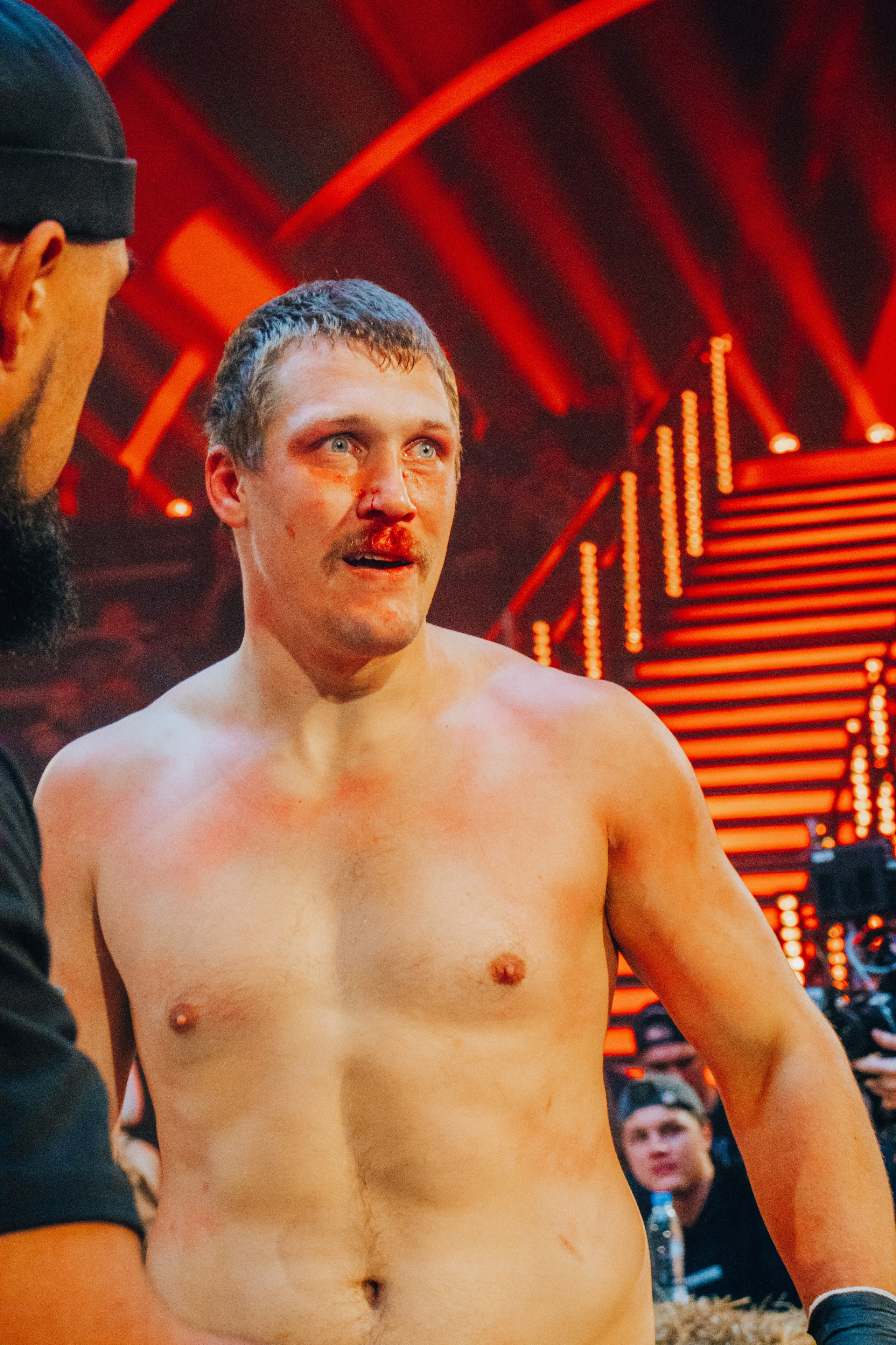 Кулачные бои TopDog. Анастасия Тен