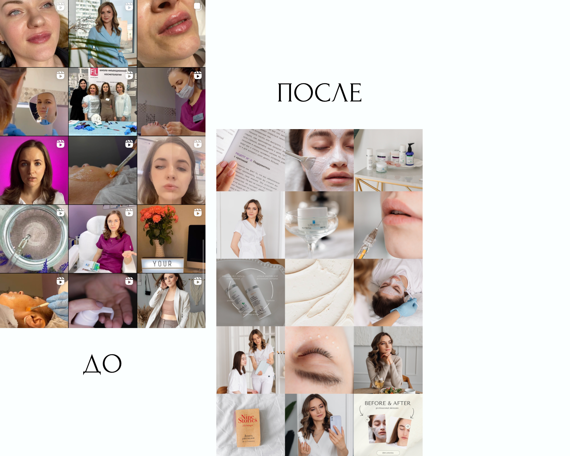 Съемка контента для косметолога. Фотограф товаров для соцсетей - инстаграм, вконтакте. Контент-фотограф в Москве Хныкина Лена