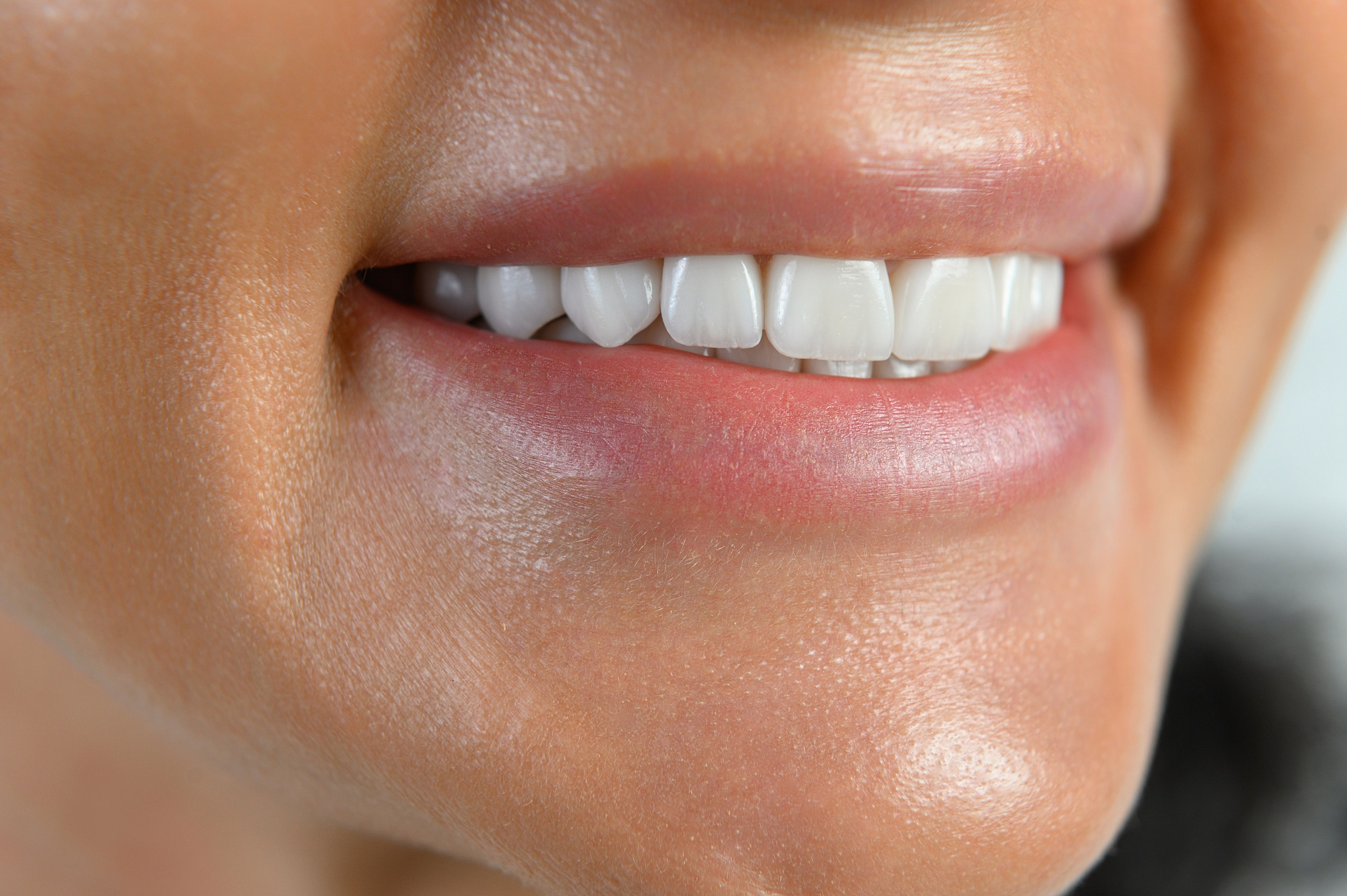 Профессиональная фото и видео съемка стоматологии. Виниры