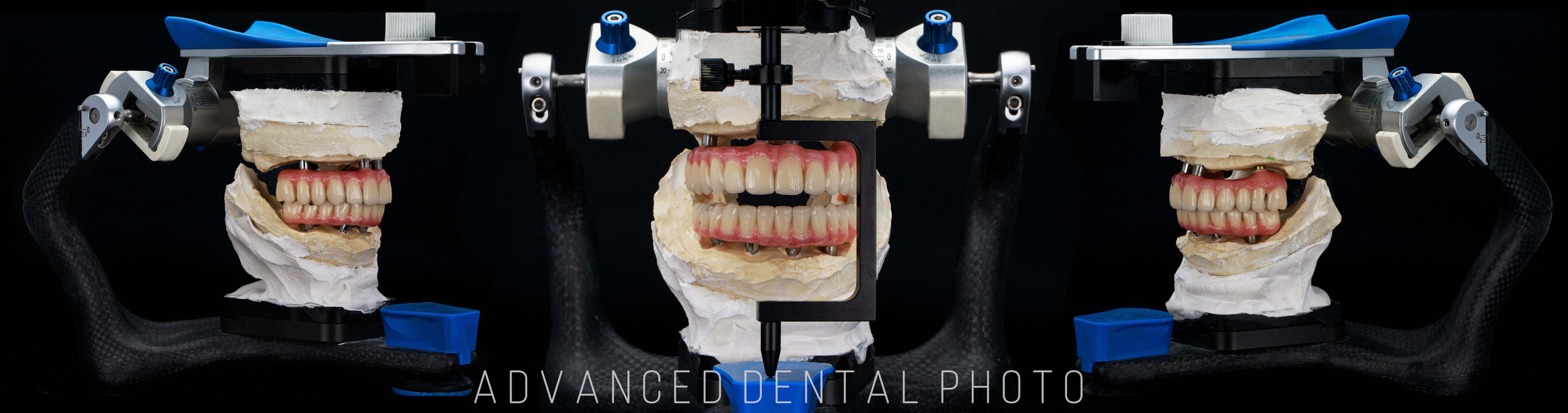 Ортопедия. Дентал фотограф — видеограф Денис Дорошенко