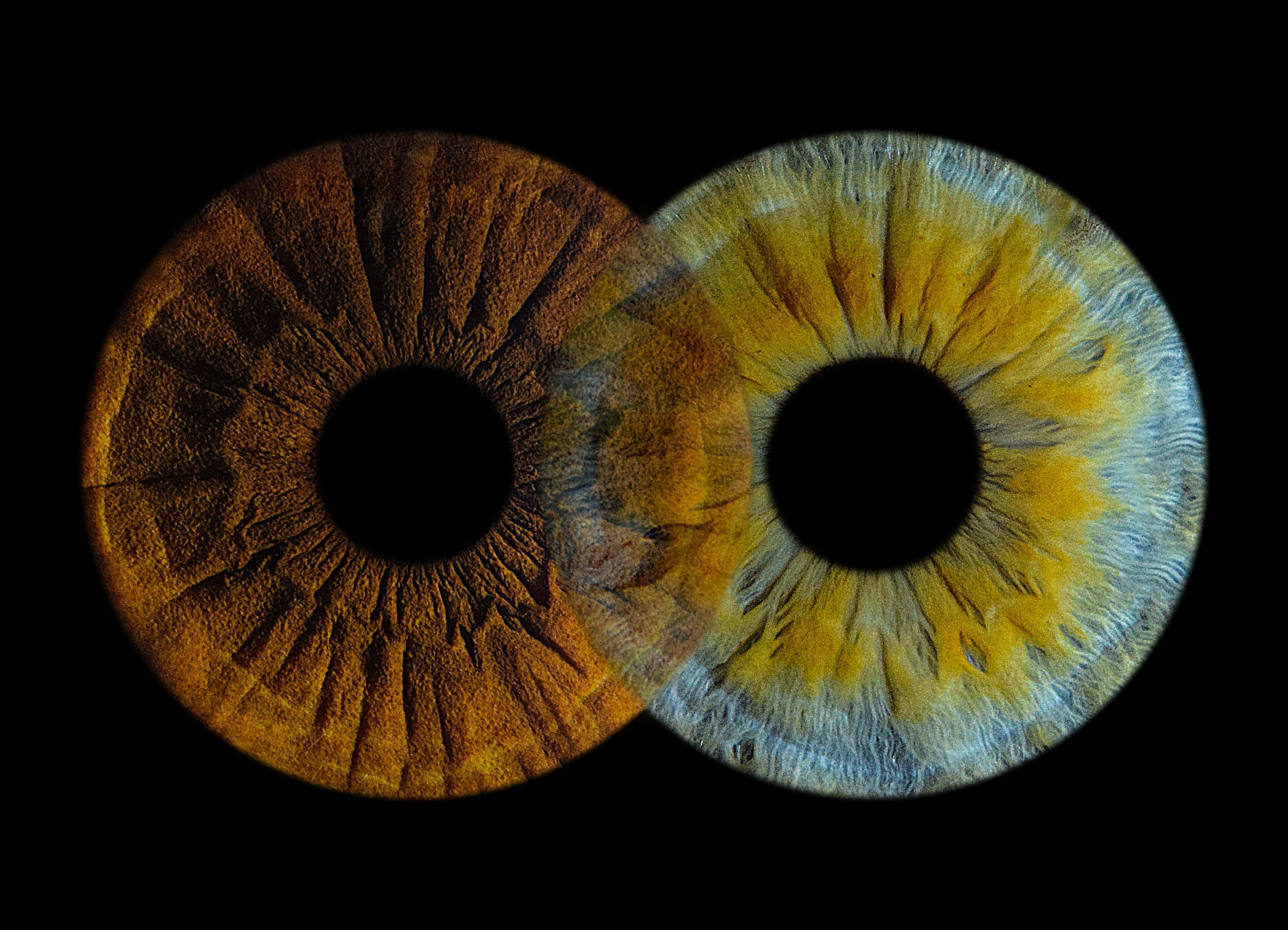 Портфолио. EYEtob | Фотография радужной оболочки | Тобольск