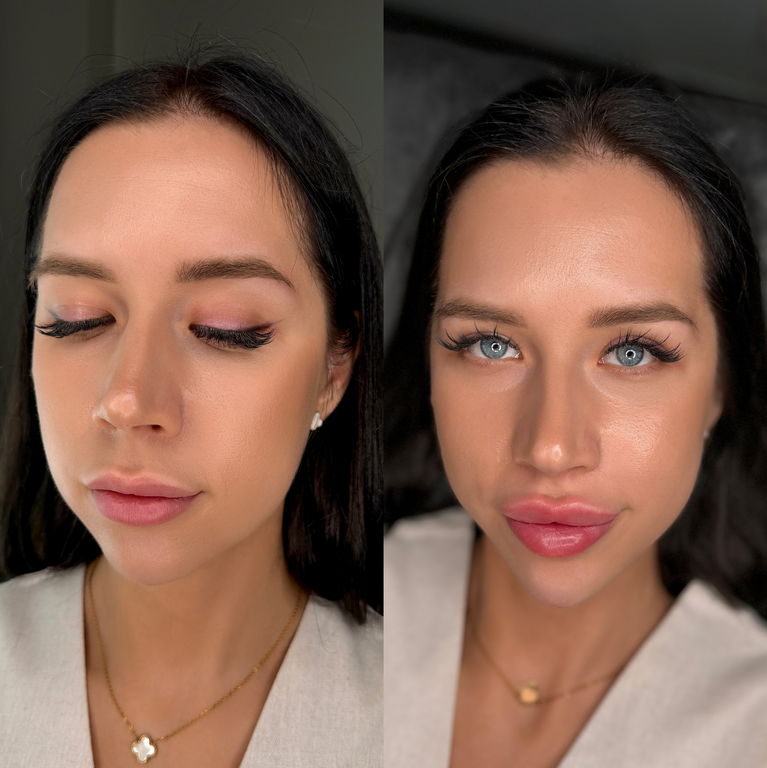 Инъекционная косметология. Студия перманентного макияжа, косметологии и массажа SYMMETRY в Москве, м. Киевская