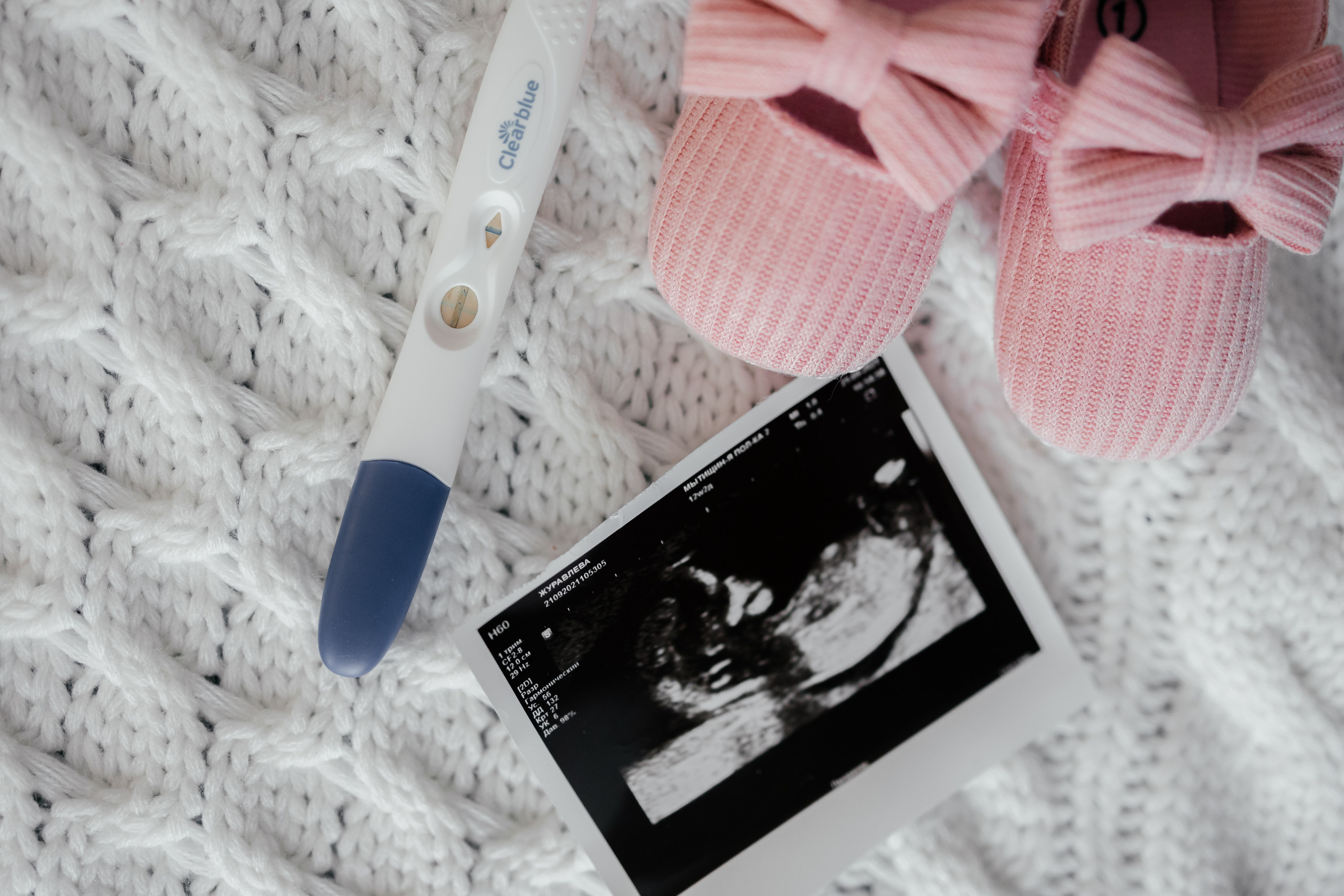 В ожидании.....♥. Свадебный фотограф в Москве