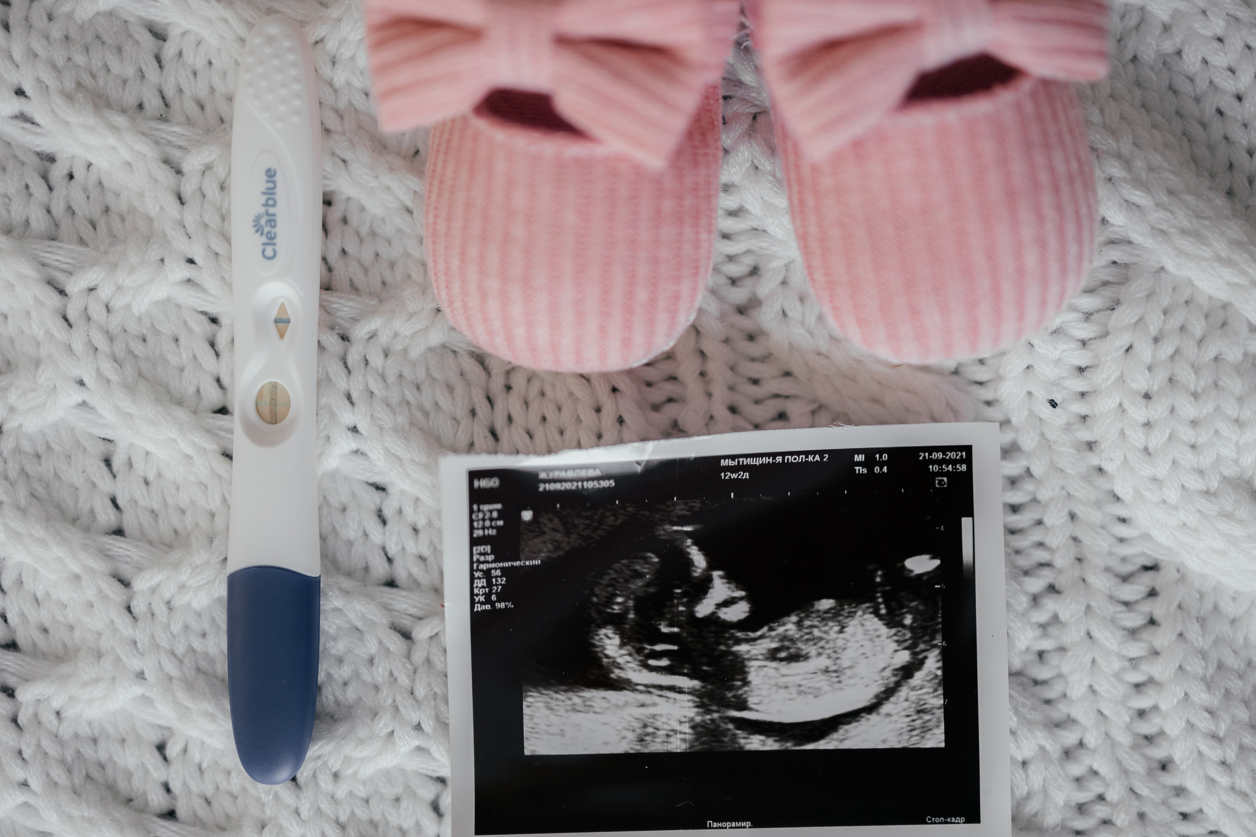 В ожидании.....♥. Свадебный фотограф в Москве