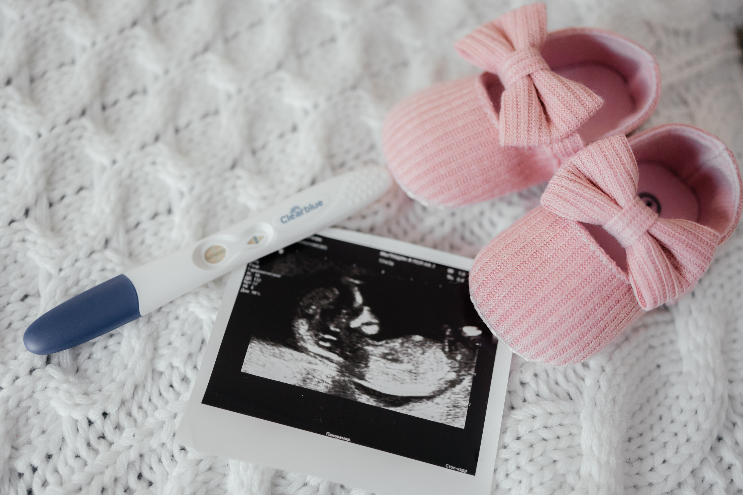 В ожидании.....♥. Свадебный фотограф в Москве