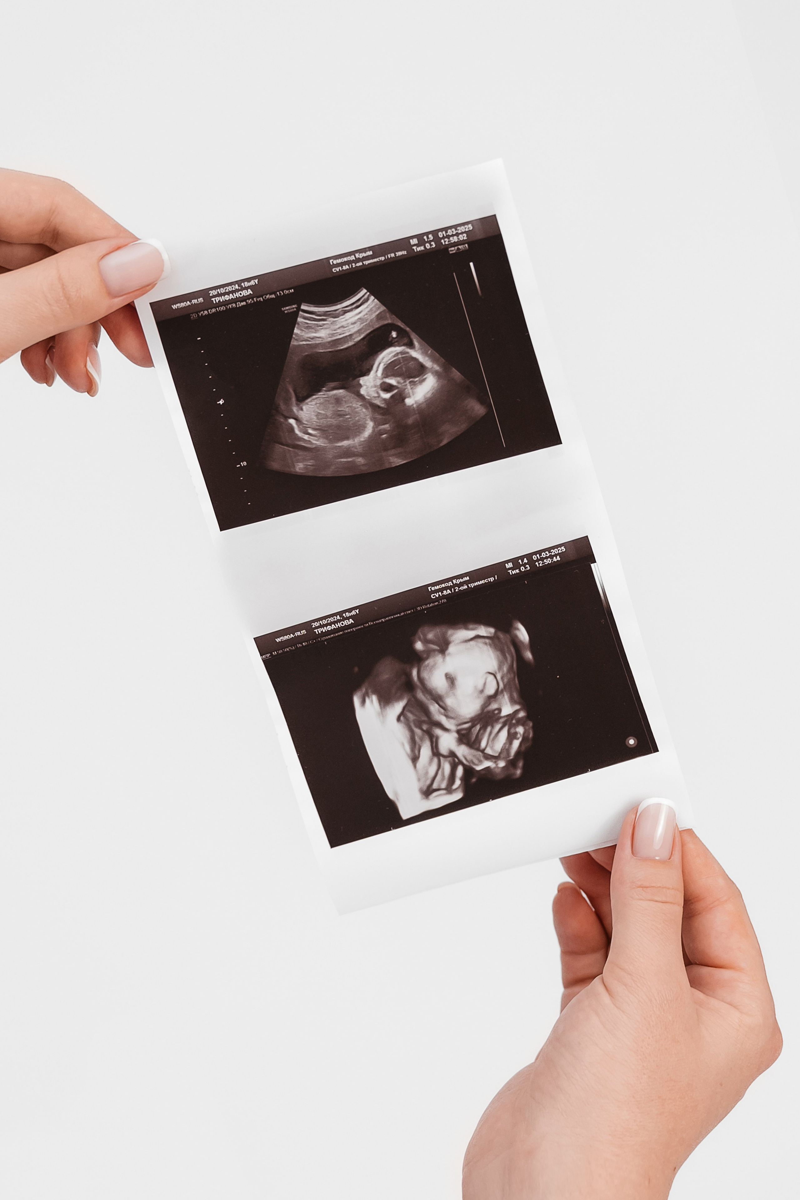 Фотограф беременности в Феодосии