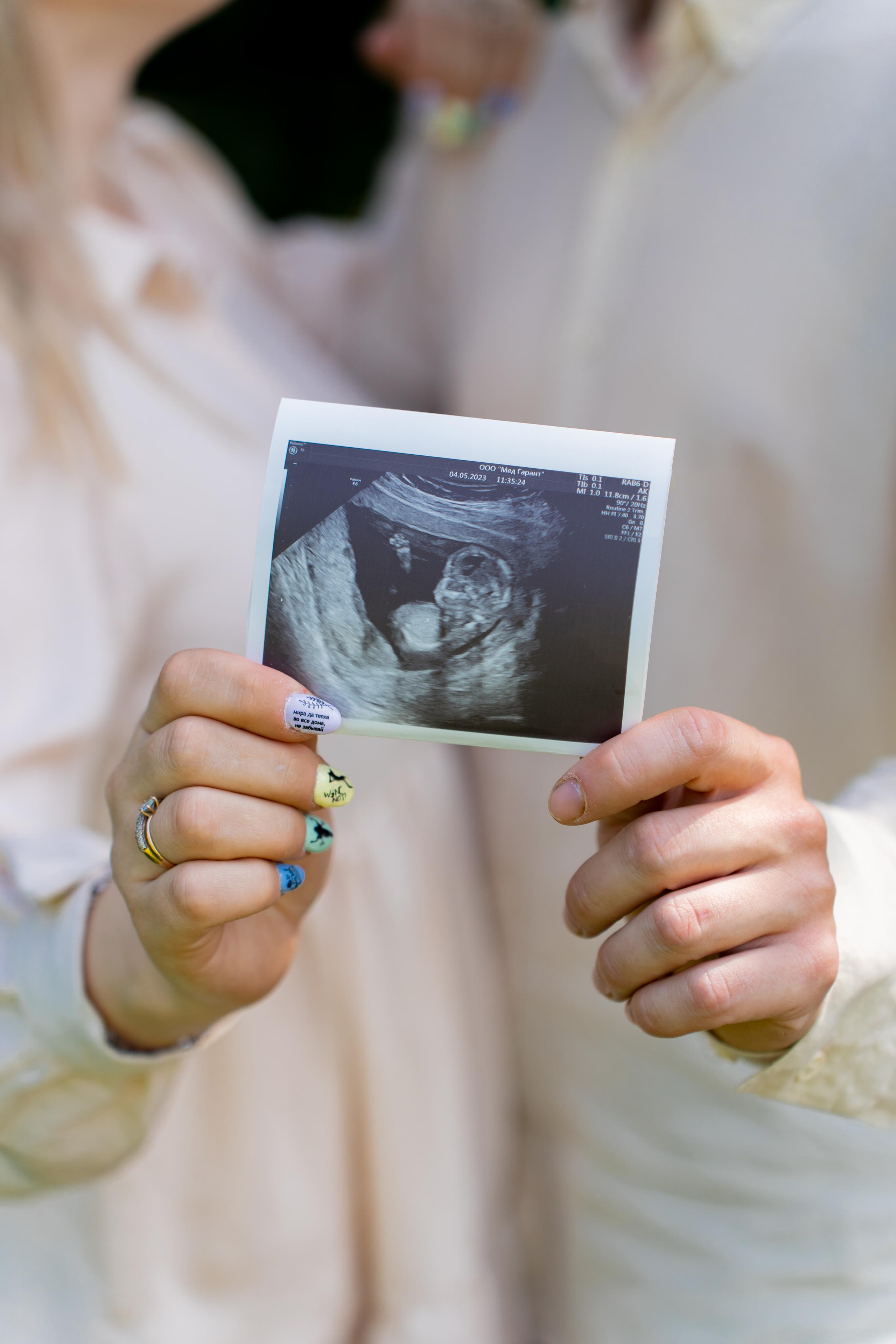 У нас будет малыш. Фотограф Москва. Базанова Анастасия