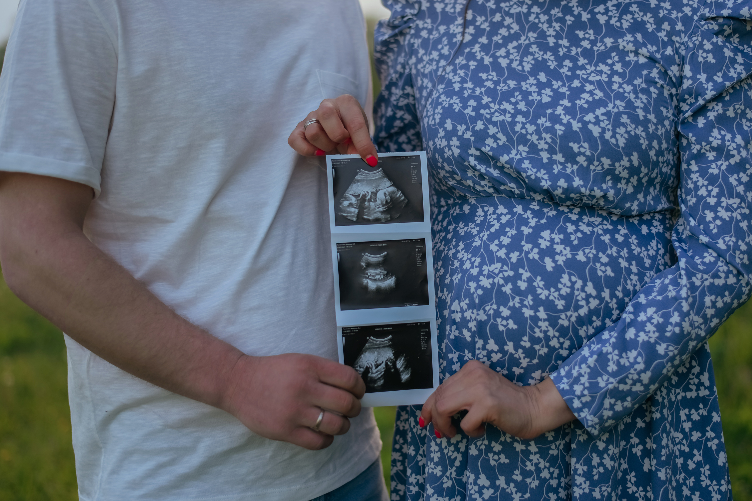 Беременность. Фотограф Подольск