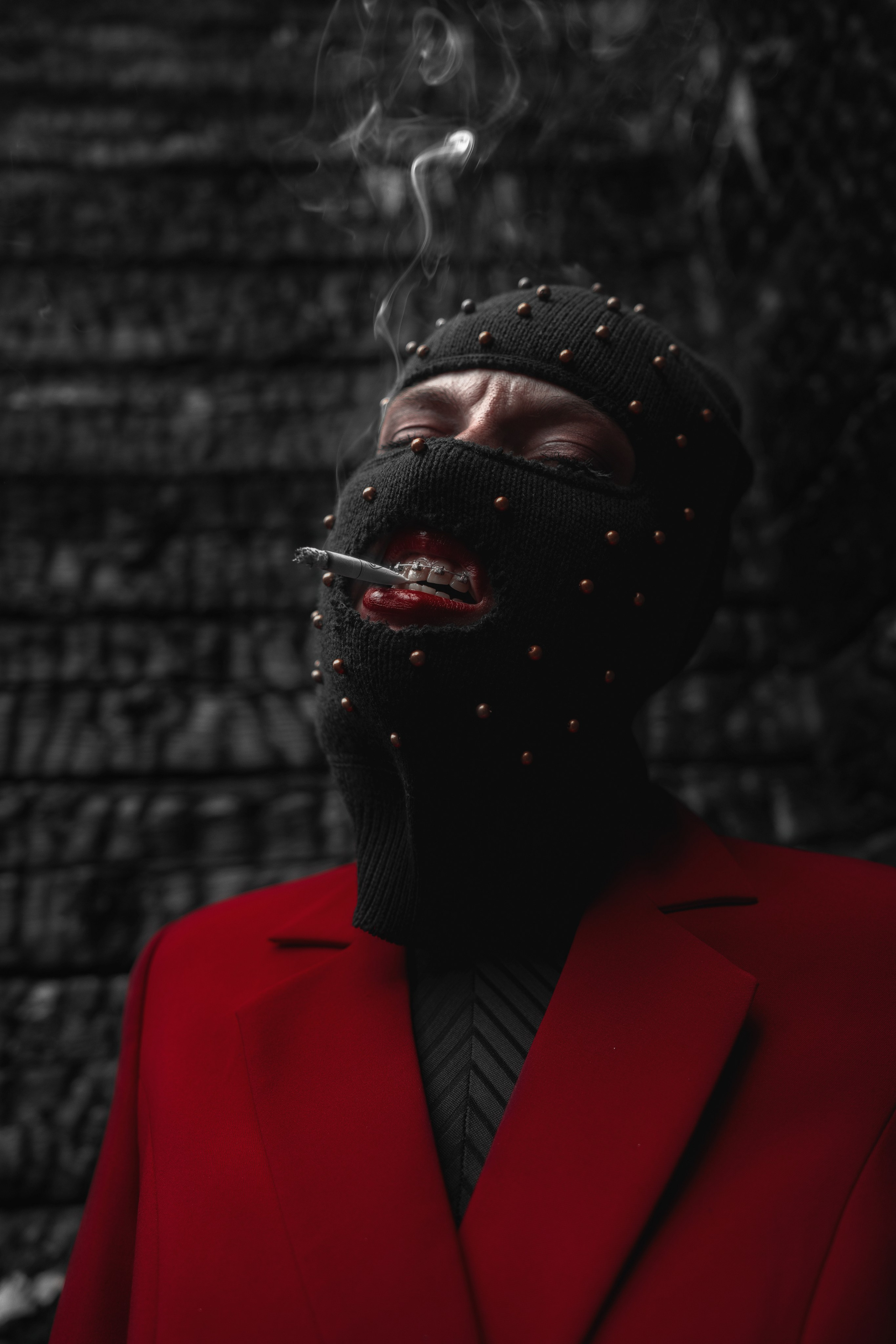 BRACES. Sergey,kuzichev