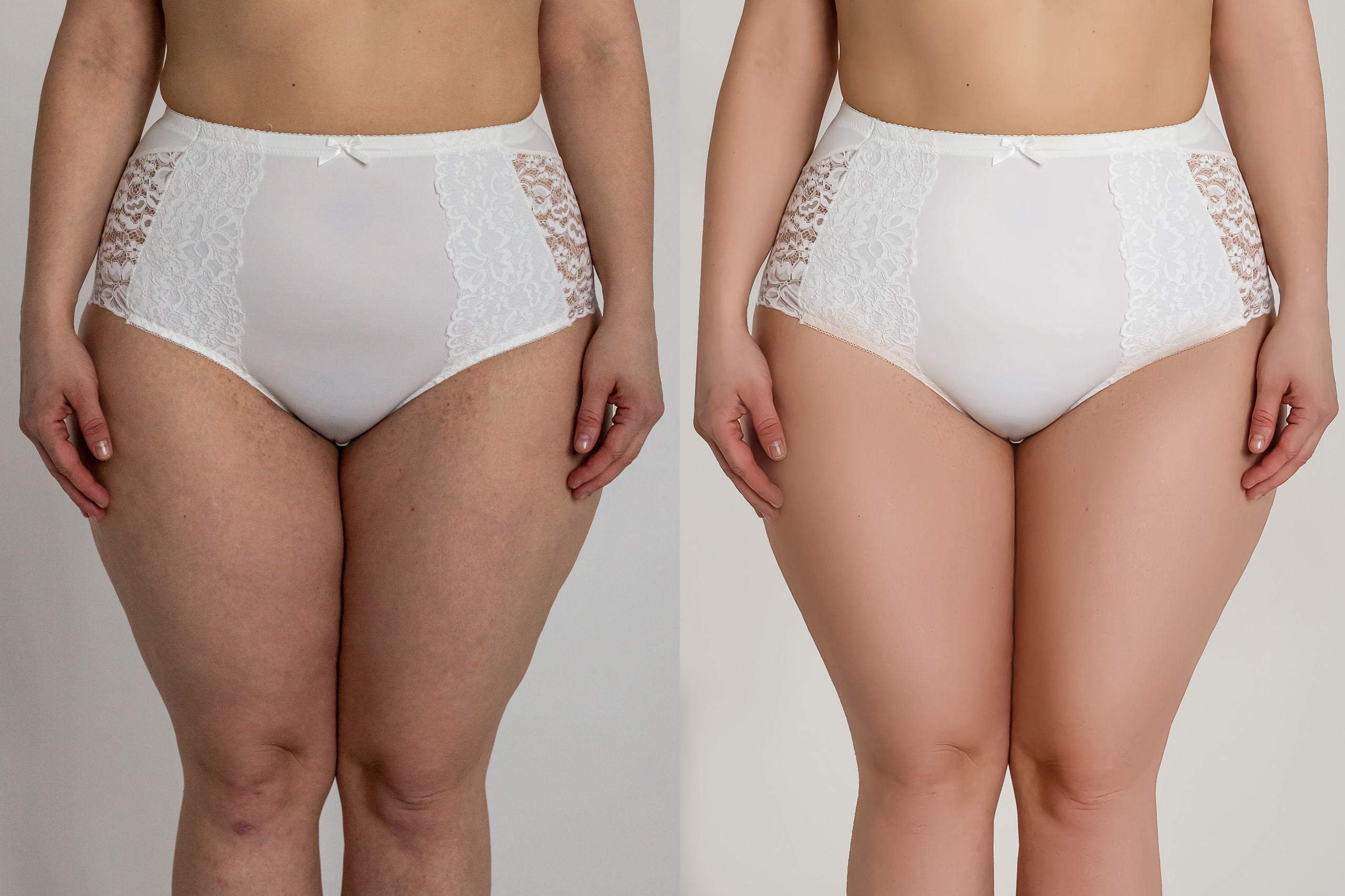 Деликатная обработка портретов для рекламы нижнего белья | Студия SVITHART