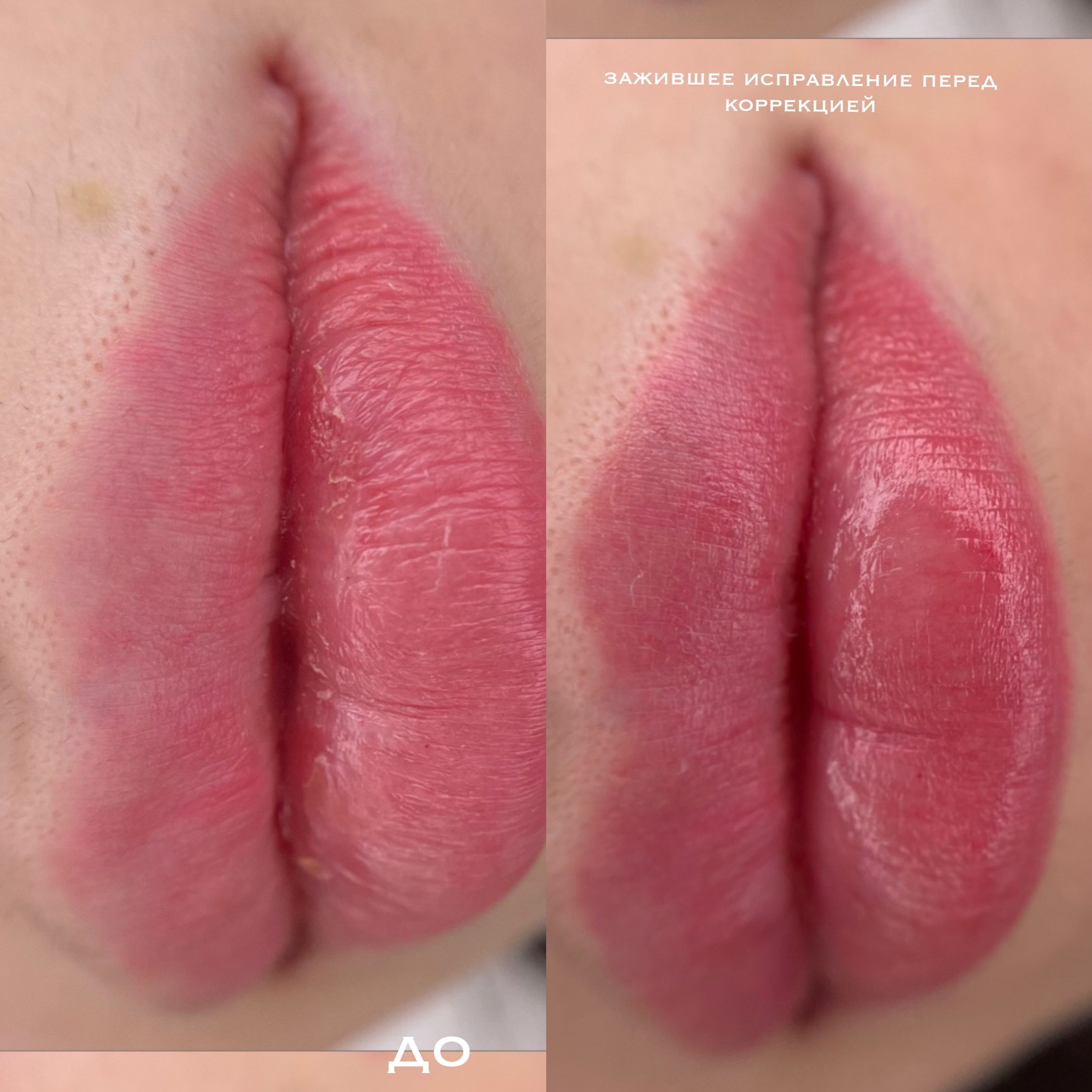 ГУБЫ зажившие. Перманентный макияж и удаление старого татуажа в Ростове-на-Дону Дарья Исакова