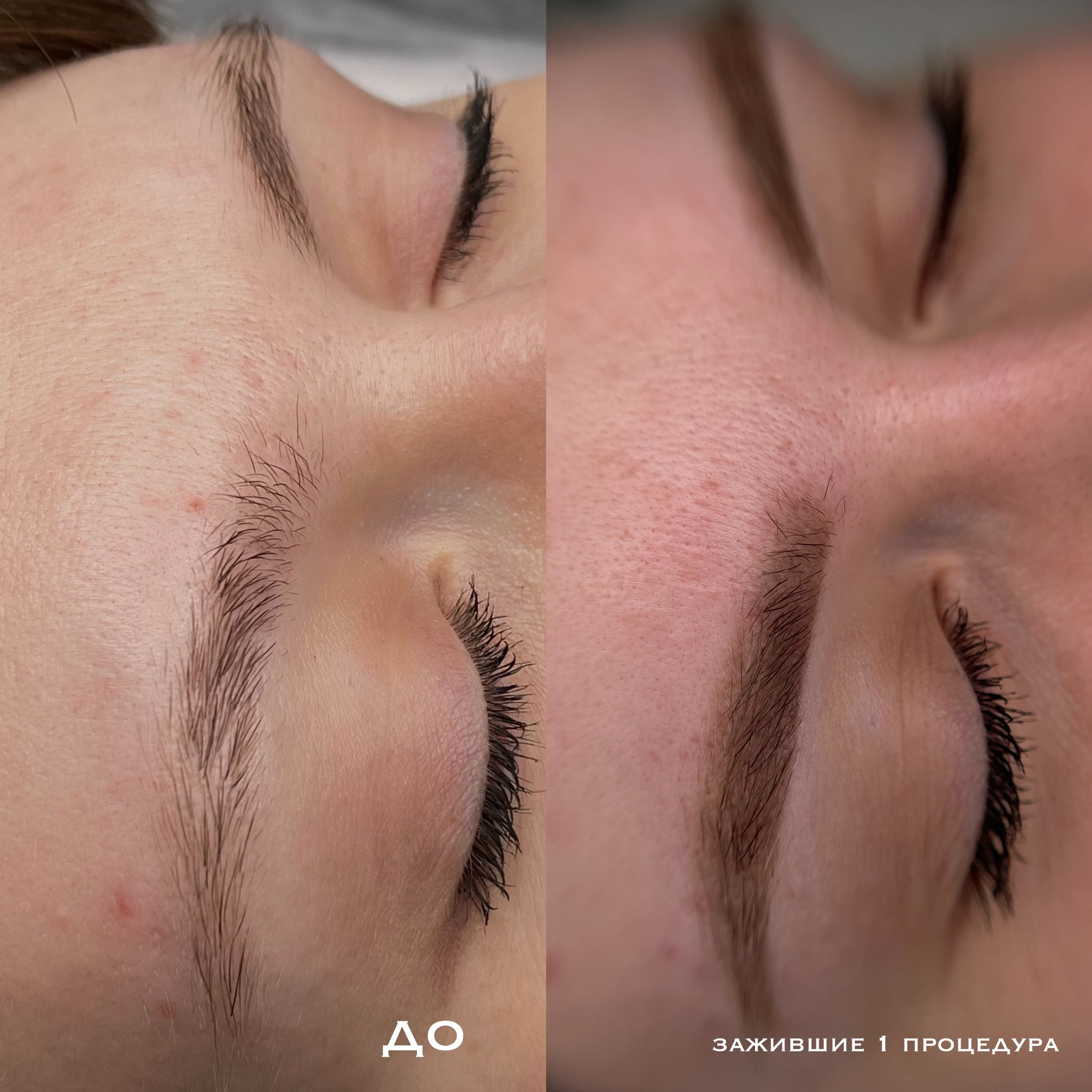 БРОВИ зажившие. Перманентный макияж и удаление старого татуажа в Ростове-на-Дону Дарья Исакова