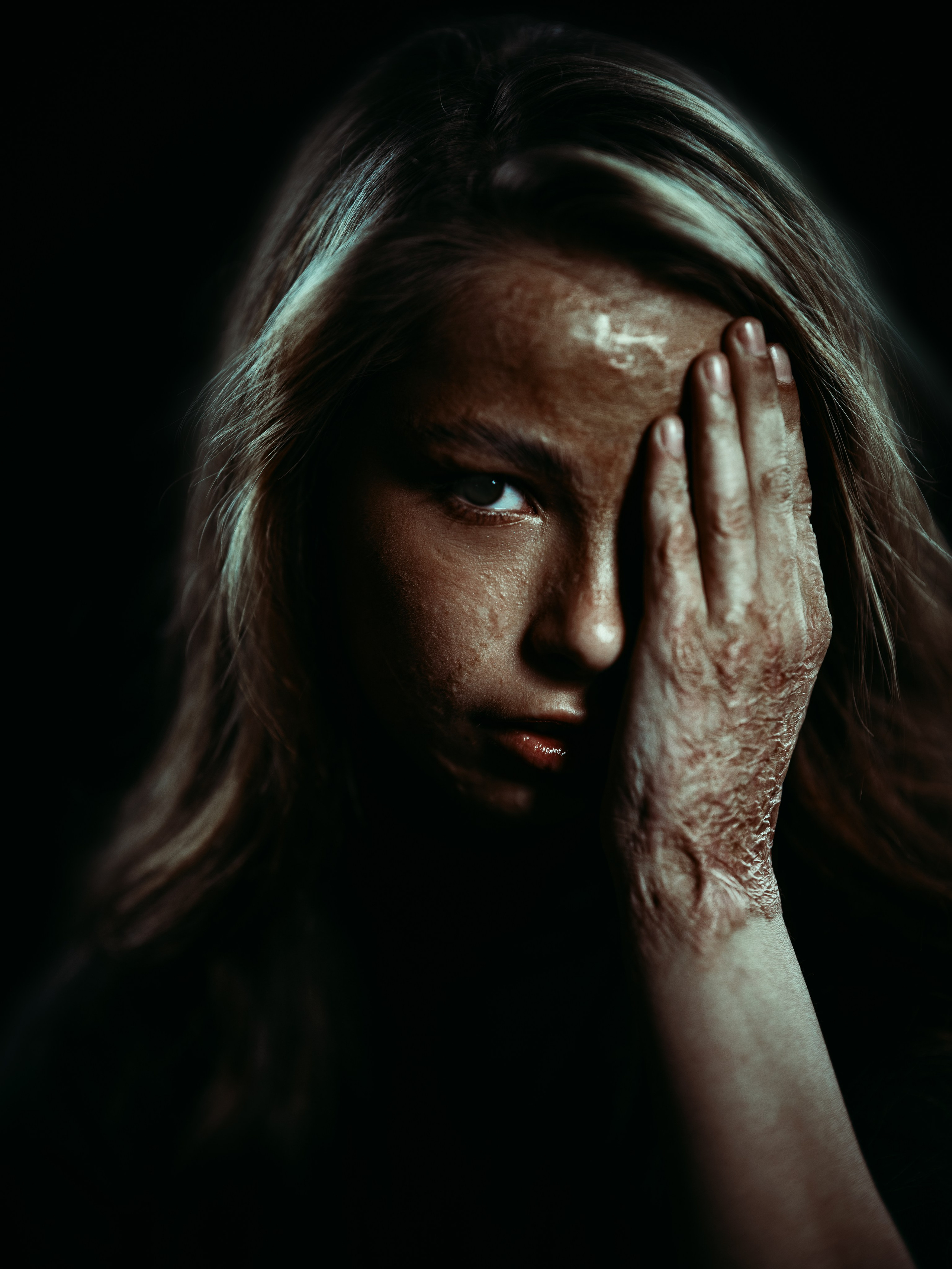 После пожара. Фотограф Олег Сотник