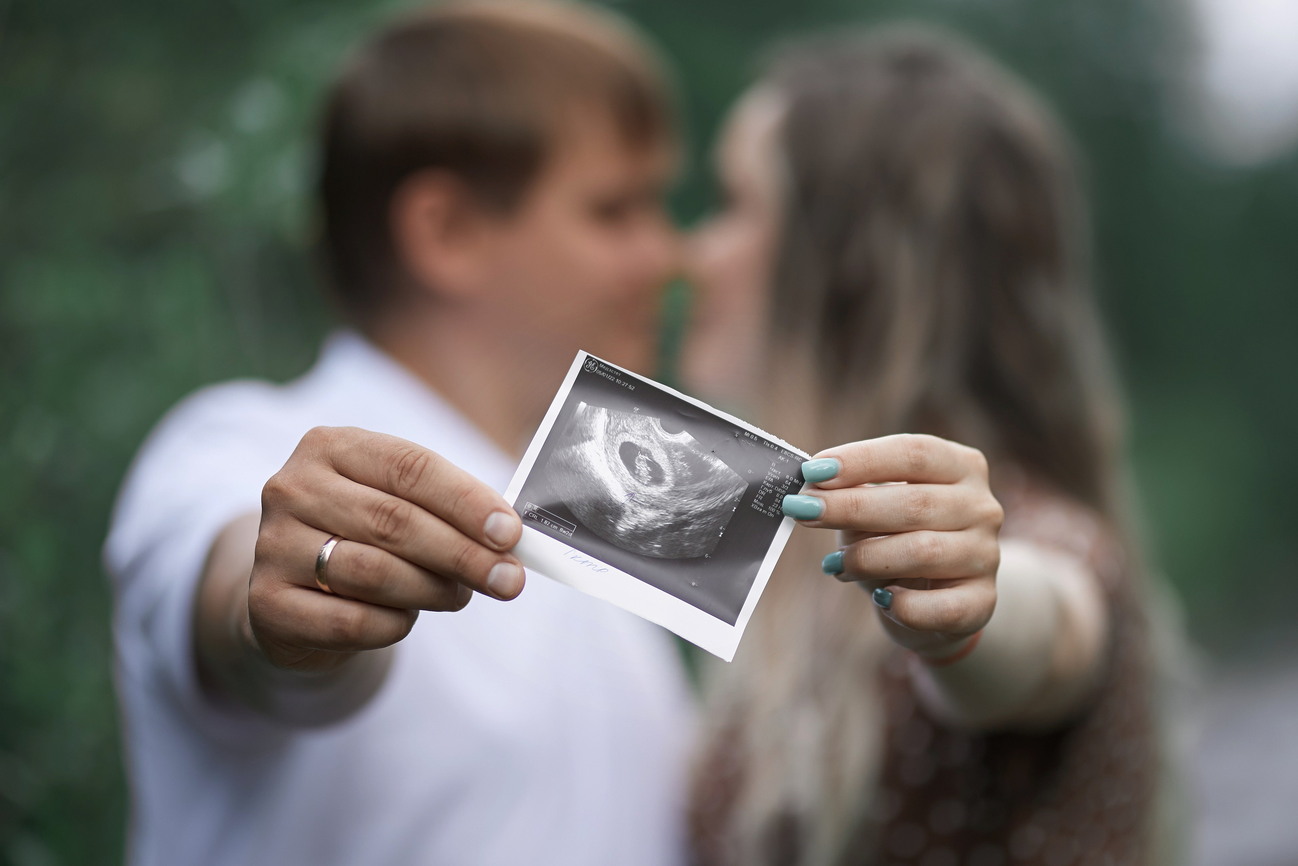 Фотосессия Love Story в Тынде — Валентин Мельников