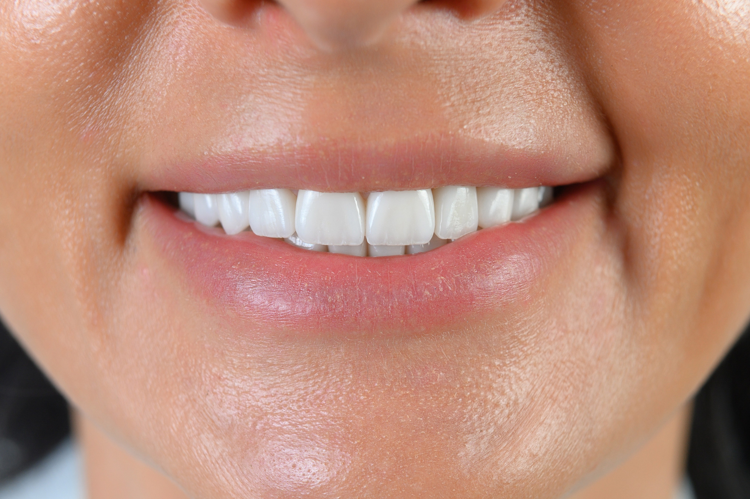 Профессиональная фото и видео съемка стоматологии. Виниры