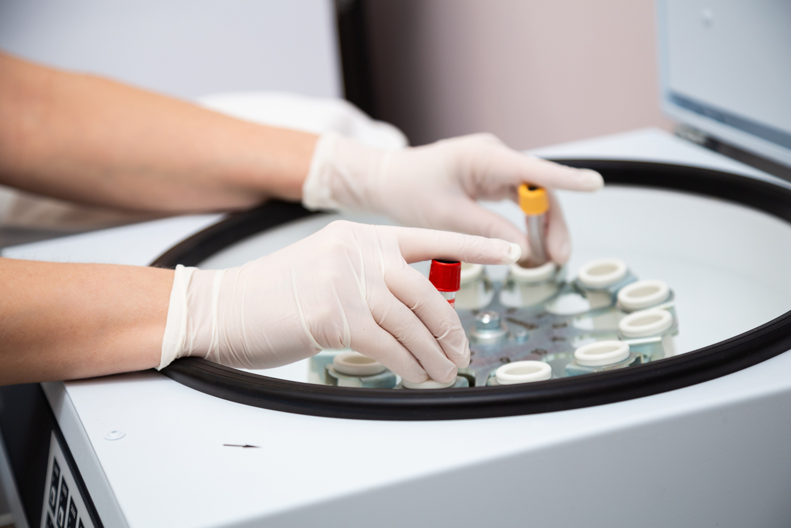 Клиника иммунологии и аллергологии Smartclinic. Свадебный фотограф Пермь Олеся Брагина