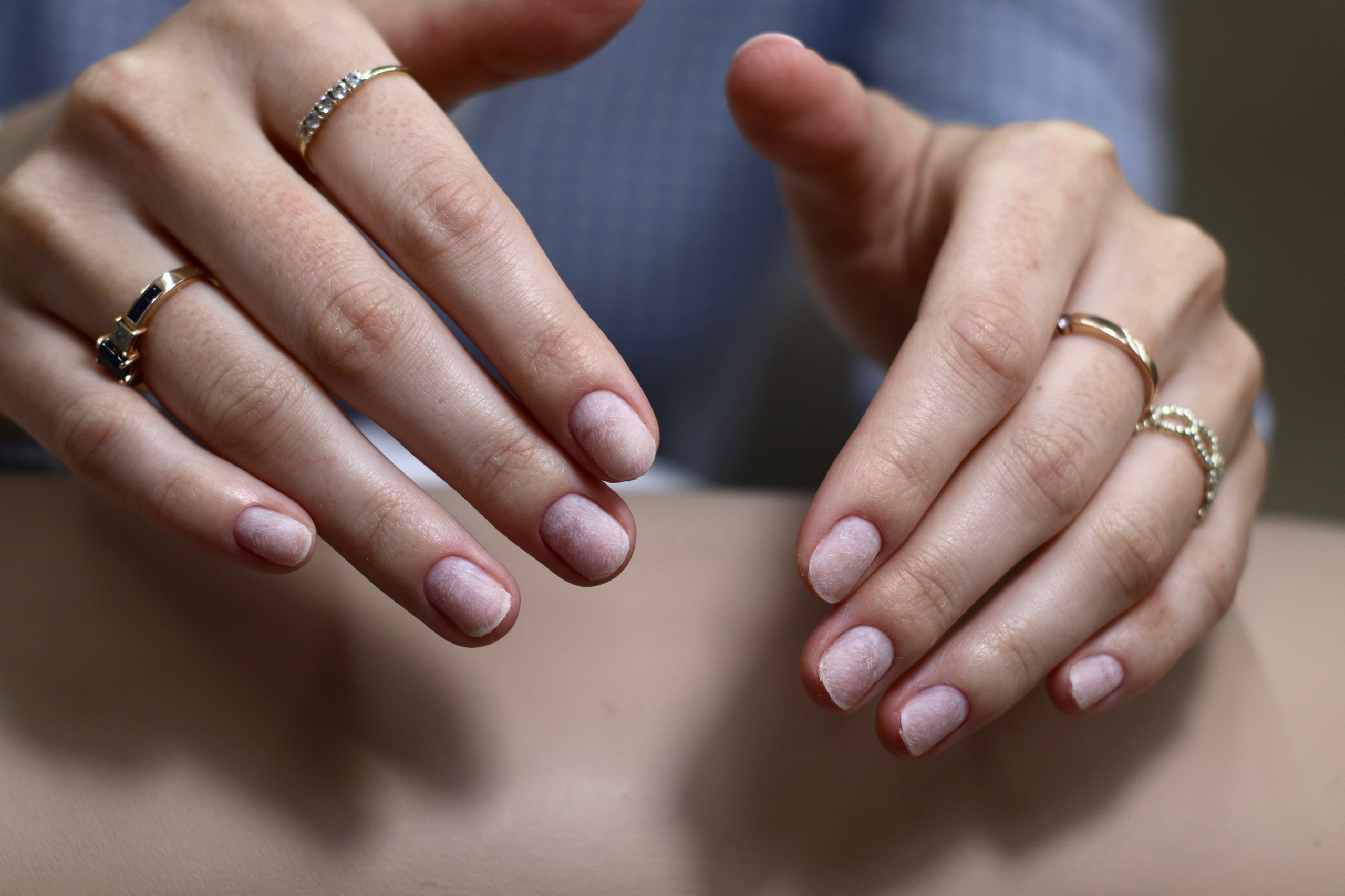 NOGTEPEEL. Glow Models