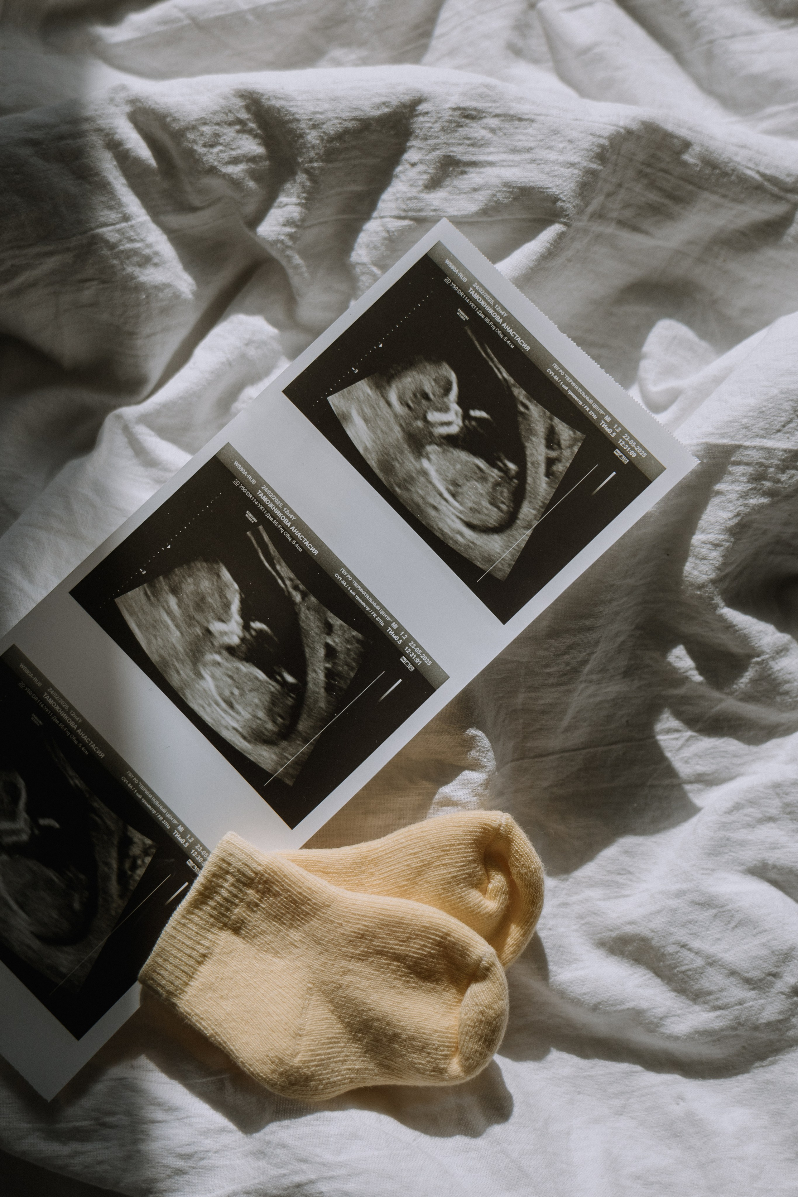 Беременность. Свадебный фотограф Юлия Галкина Ростов на Дону