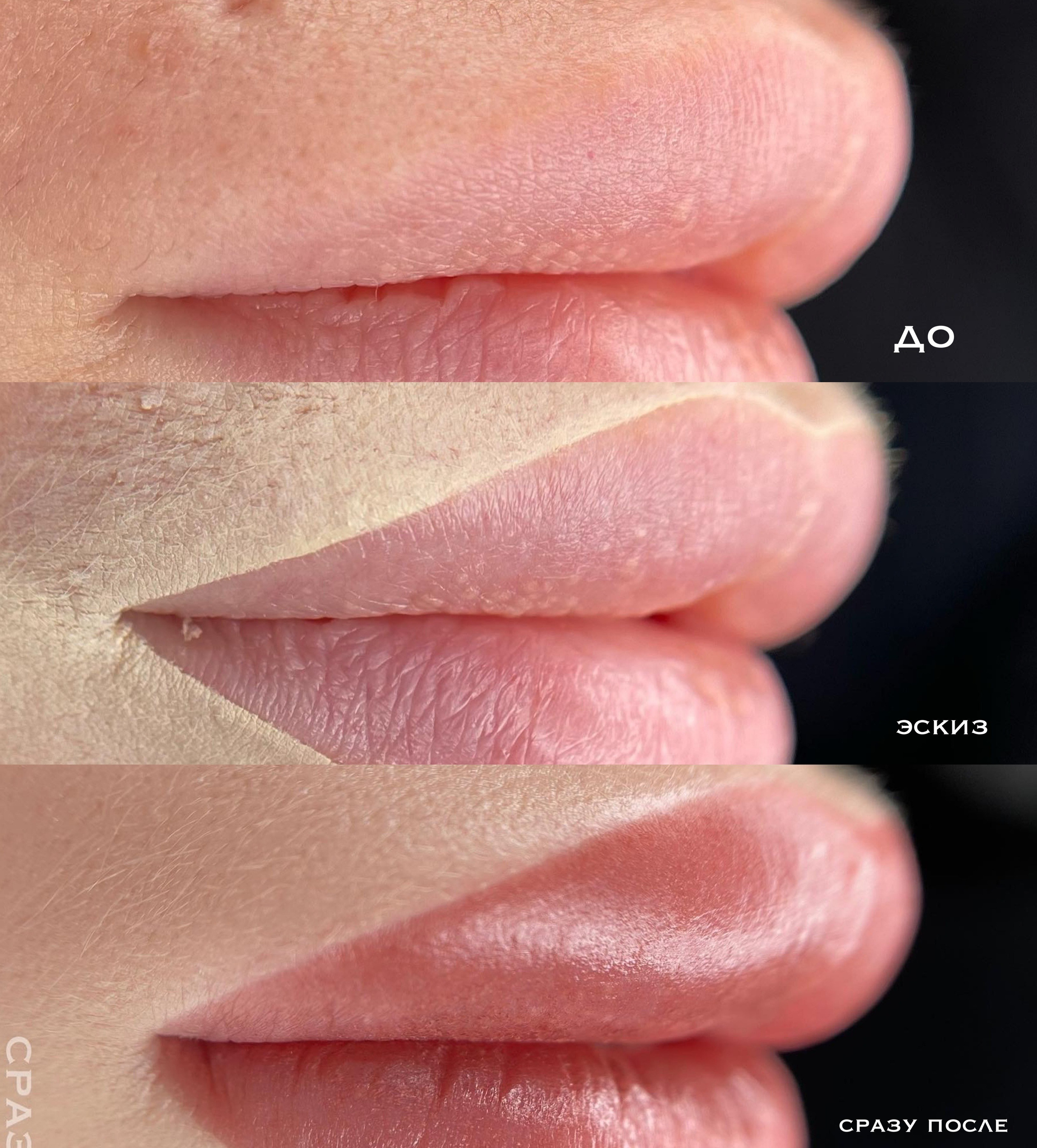 ГУБЫ сразу после процедуры. Перманентный макияж и удаление старого татуажа в Ростове-на-Дону Дарья Исакова