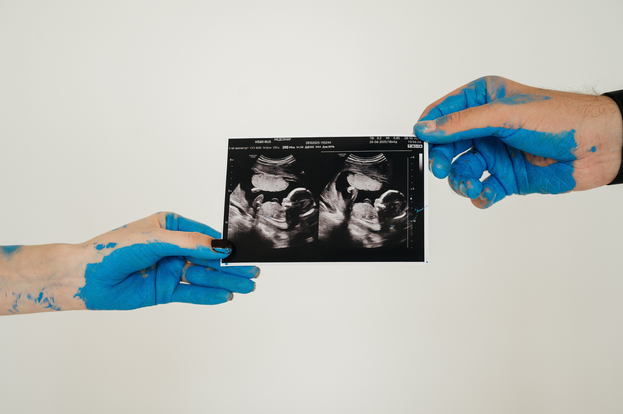 Гендер пати 🤍. Свадебный и семейный фотограф в Краснодаре Алина Мельник