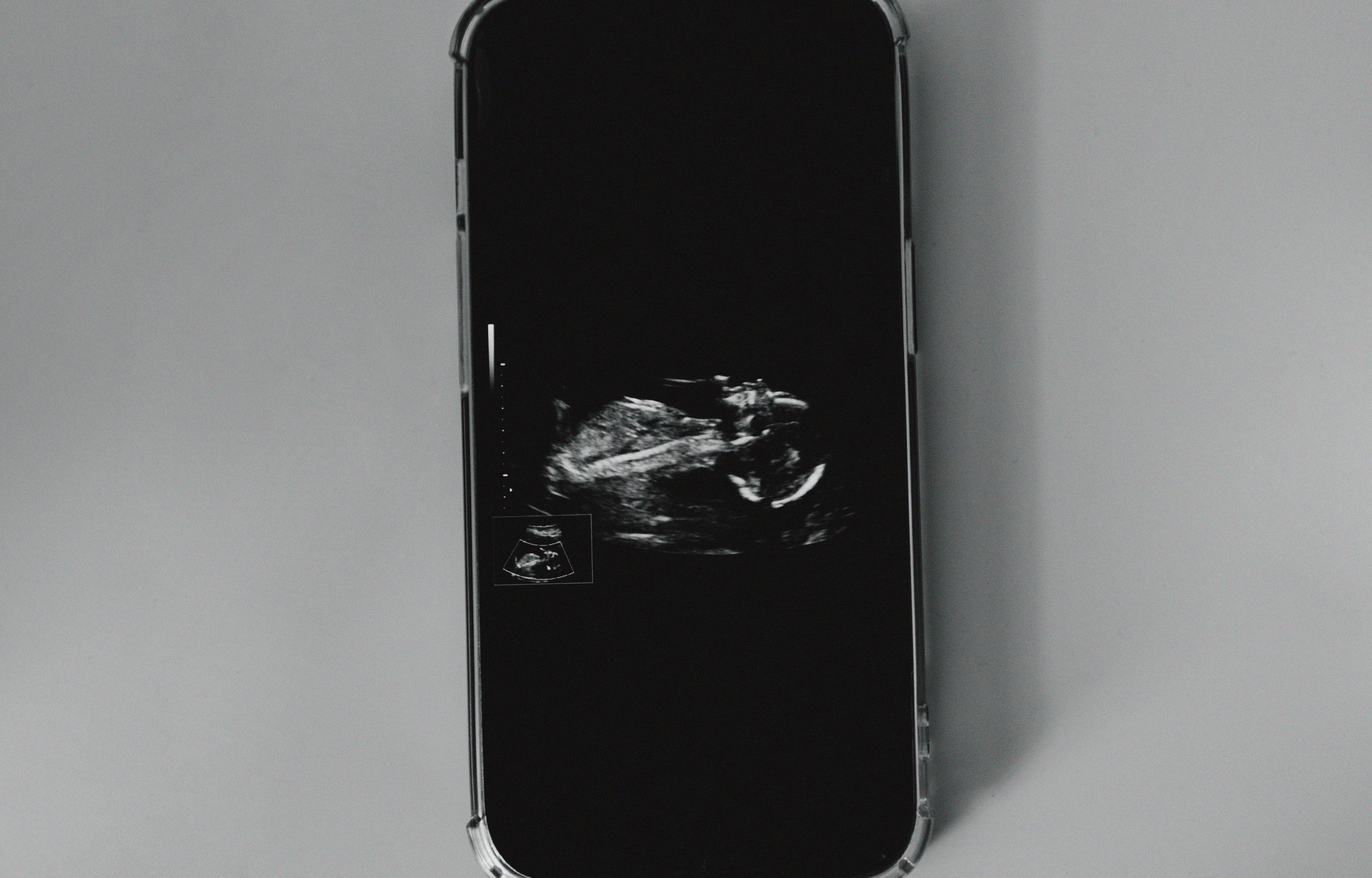 Первая фото история. Свадебный и семейный фотограф Арестенко Анастасия